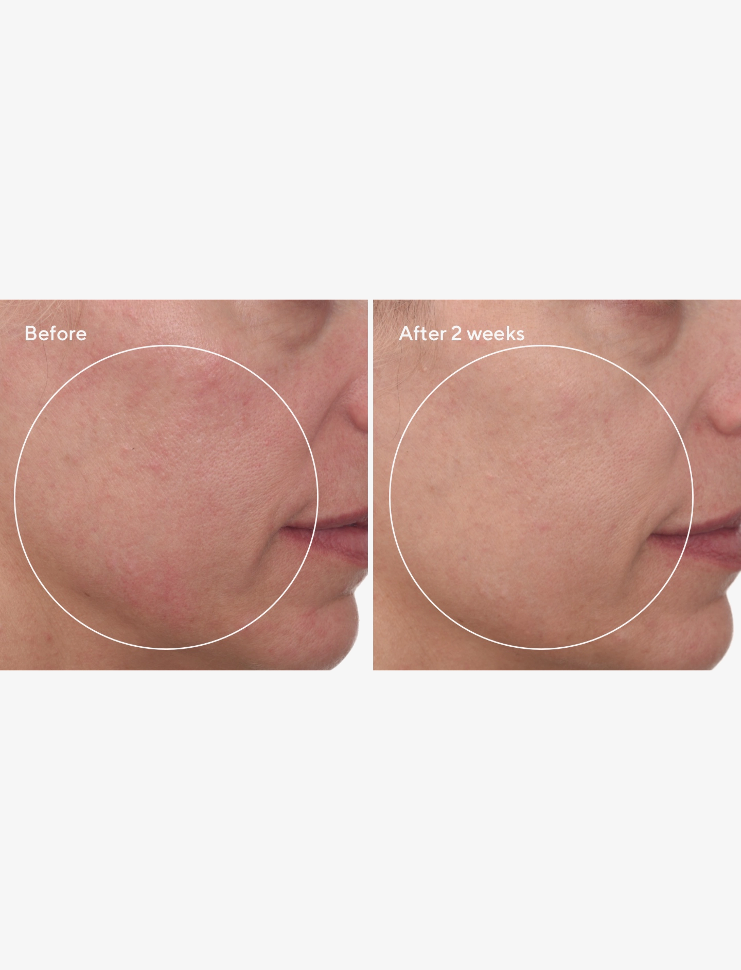 Murad - CELLULAR HYDRATION REPAIR CREAM 50 ML - dagcremer - clear - 4