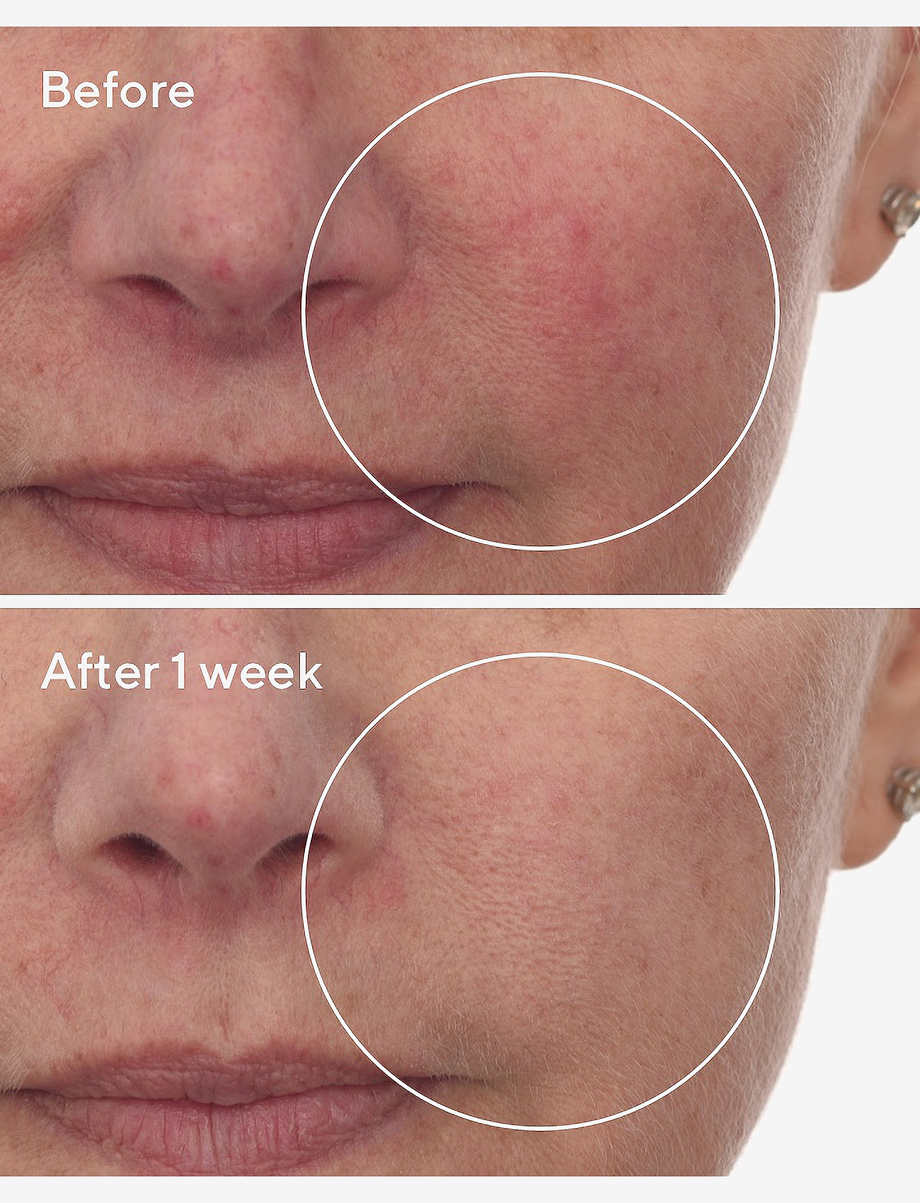 Murad - CELLULAR HYDRATION REPAIR SERUM 30 ML - serum - clear - 3