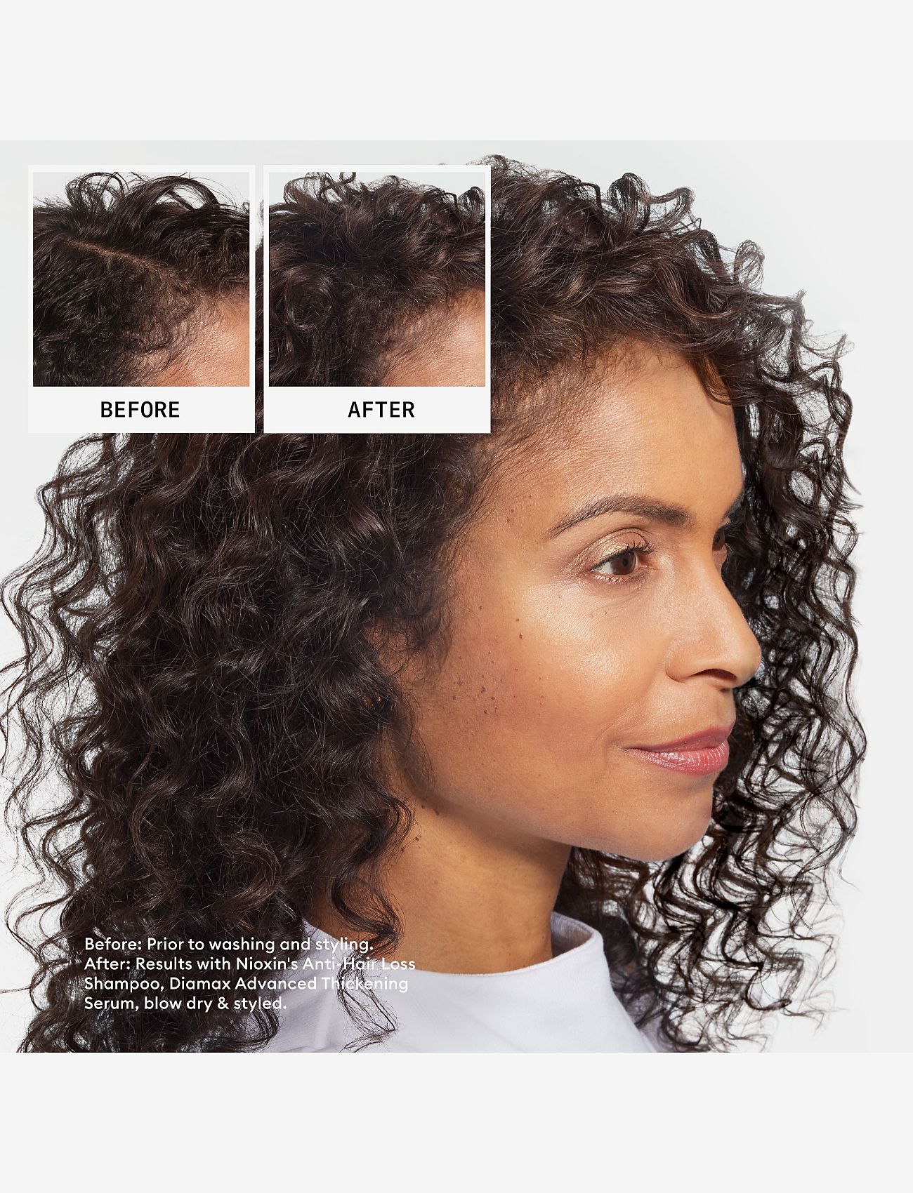 Nioxin - Nioxin Anti-Hairloss Shampoo 240 ml - scalp treatment - no color - 1