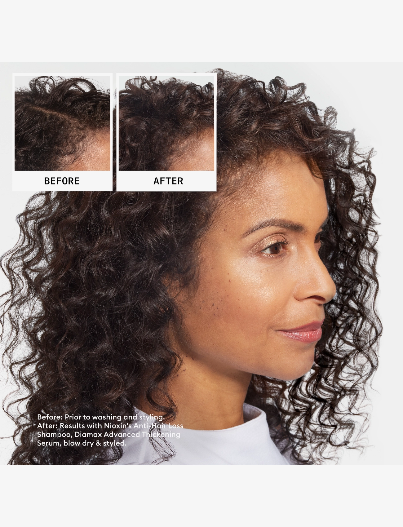 Anti-Hairloss Shampoo 2