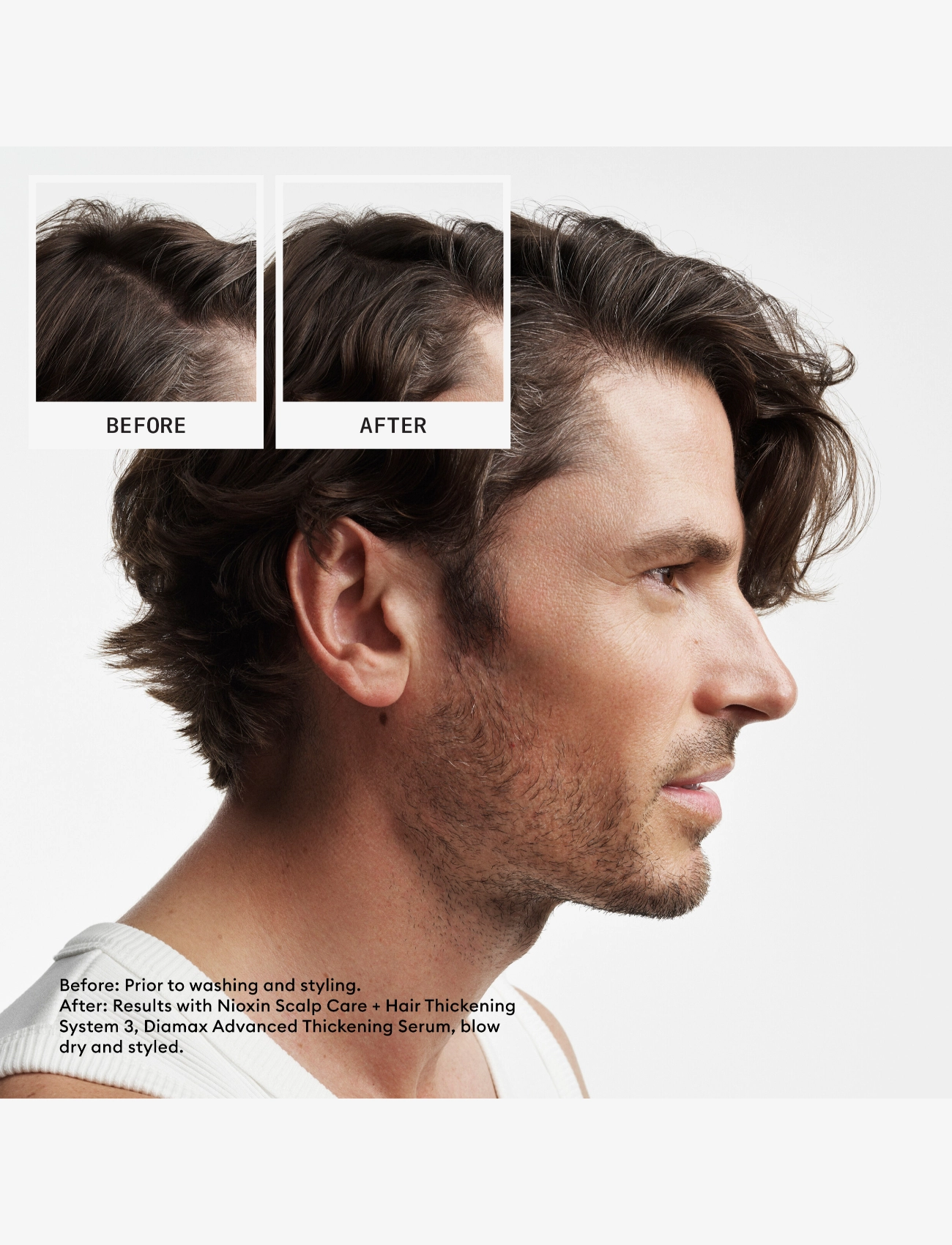 Nioxin - Nioxin System 2 Loyalty Kit - miehille - no color - 1