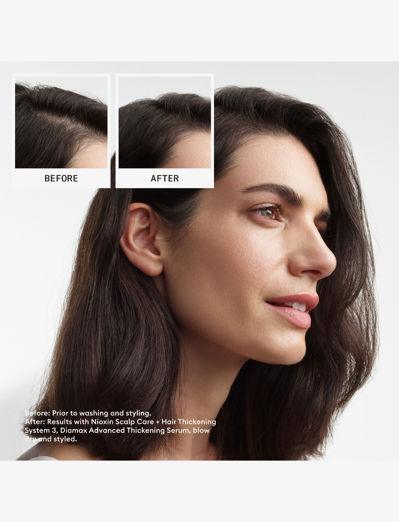 Nioxin - Nioxin System 3 Loyalty Kit for Colored Thinning Hair - gåvoset - no color - 1