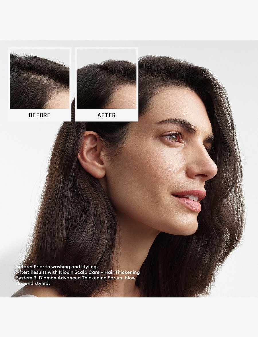 Nioxin - Nioxin System 3 Loyalty Kit for Colored Thinning Hair - no color - 1
