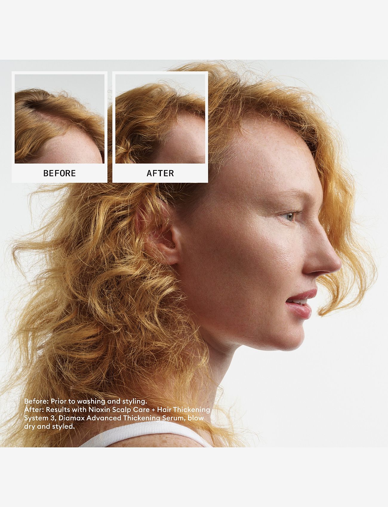 Nioxin - Nioxin System 4 Loyalty Kit for Colored Thinning Hair - til ham - no color - 1