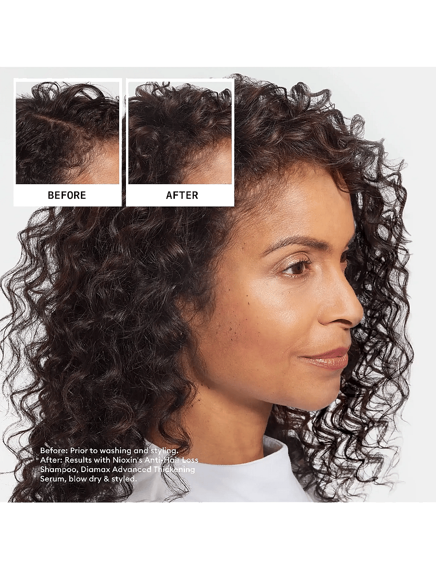 Nioxin - Nioxin Anti-Hairloss Shampoo 50ml - no color - 1