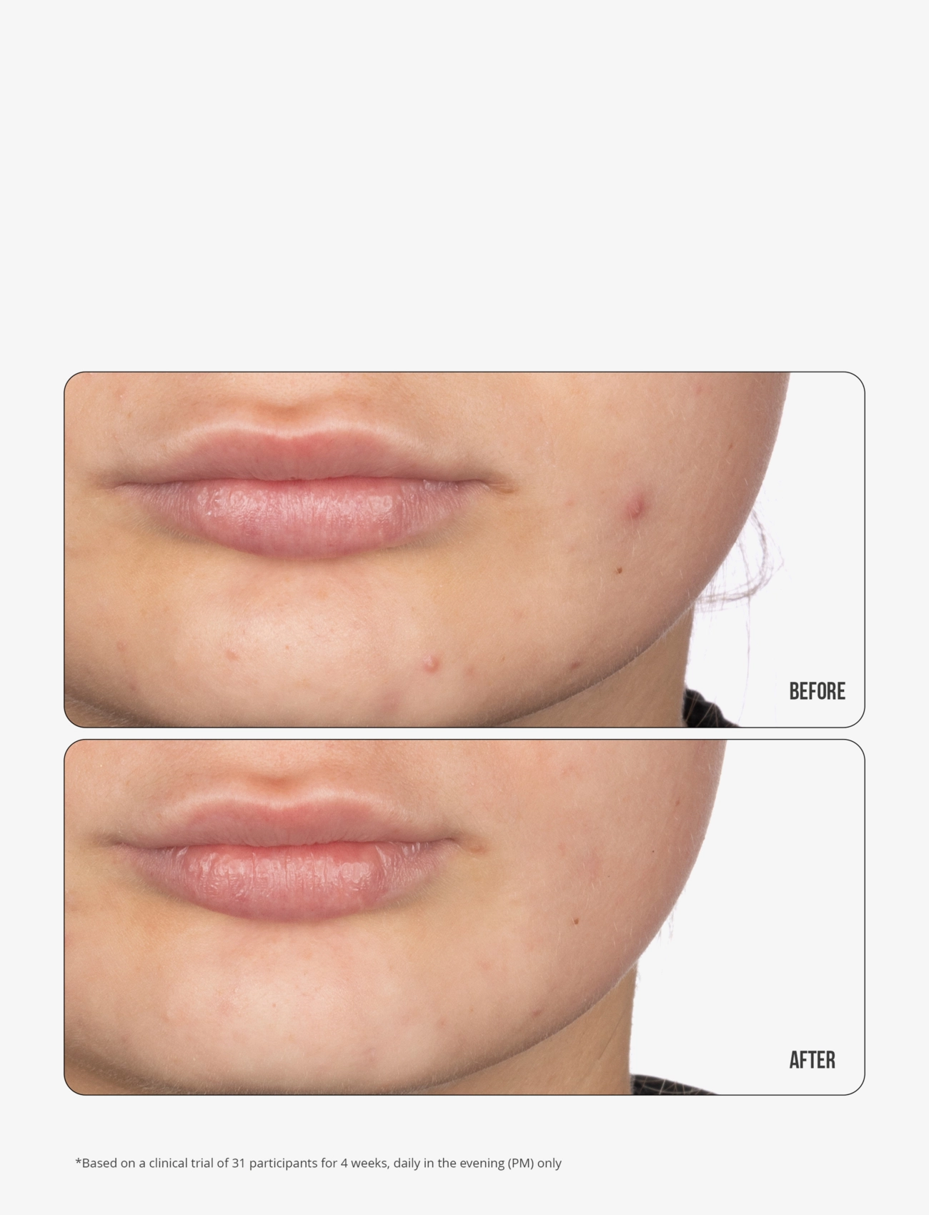 Nip+Fab - Retinol Fix Blemish Gel 15ml - odos priežiūra - no color - 1
