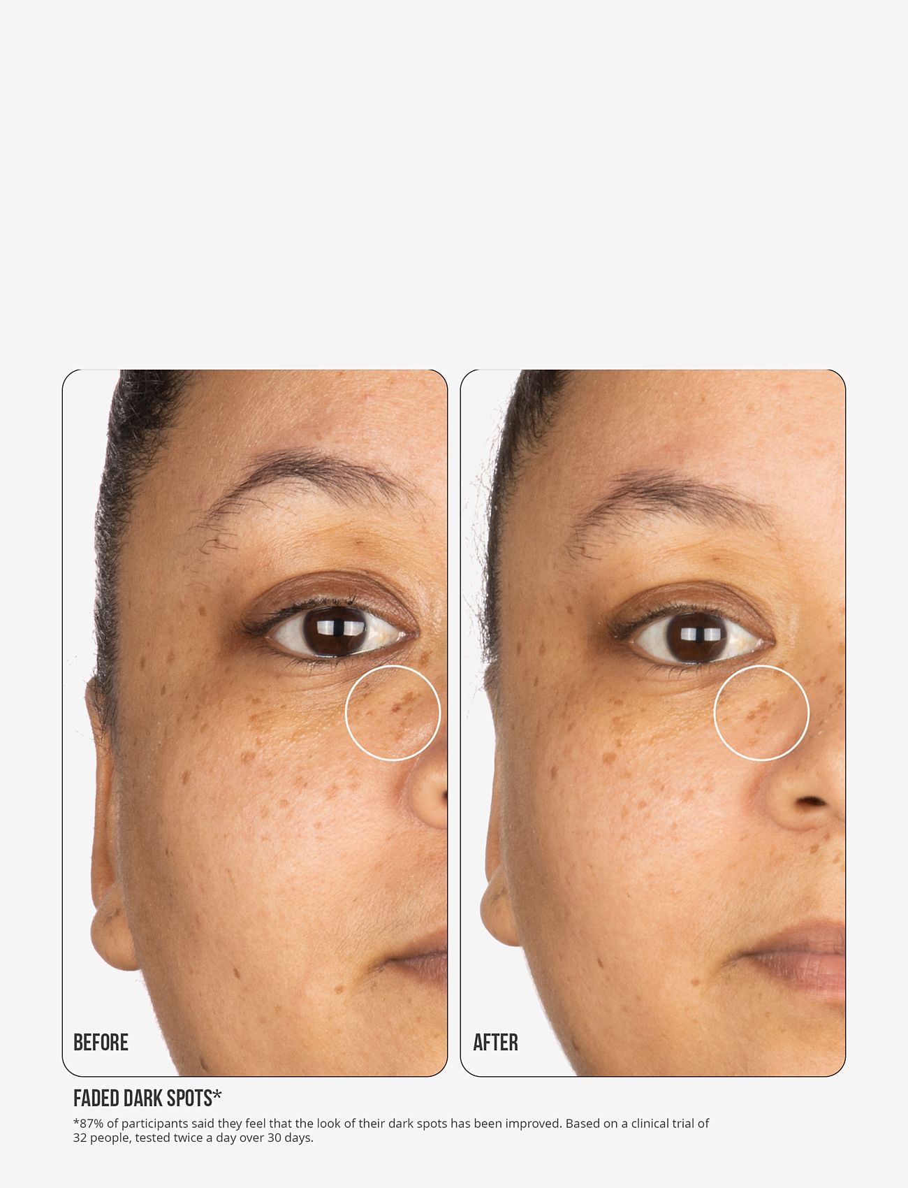 Nip+Fab - Vitamin C Fix Concentrate Extreme 15% 30ml - serum - no color - 2