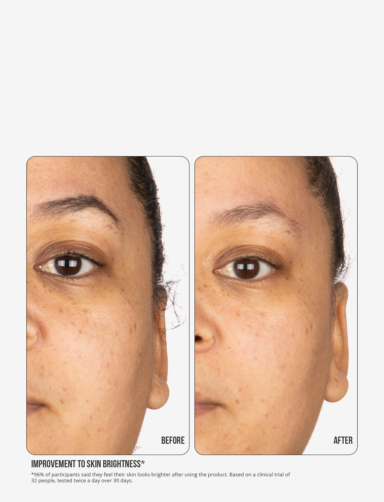 Nip+Fab - Vitamin C Fix Concentrate Extreme 15% 30ml - serum - no color - 4