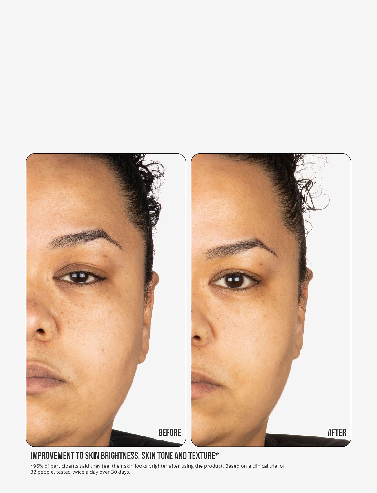 Nip+Fab - Vitamin C Fix Concentrate Extreme 15% 30ml - serum - no color - 5