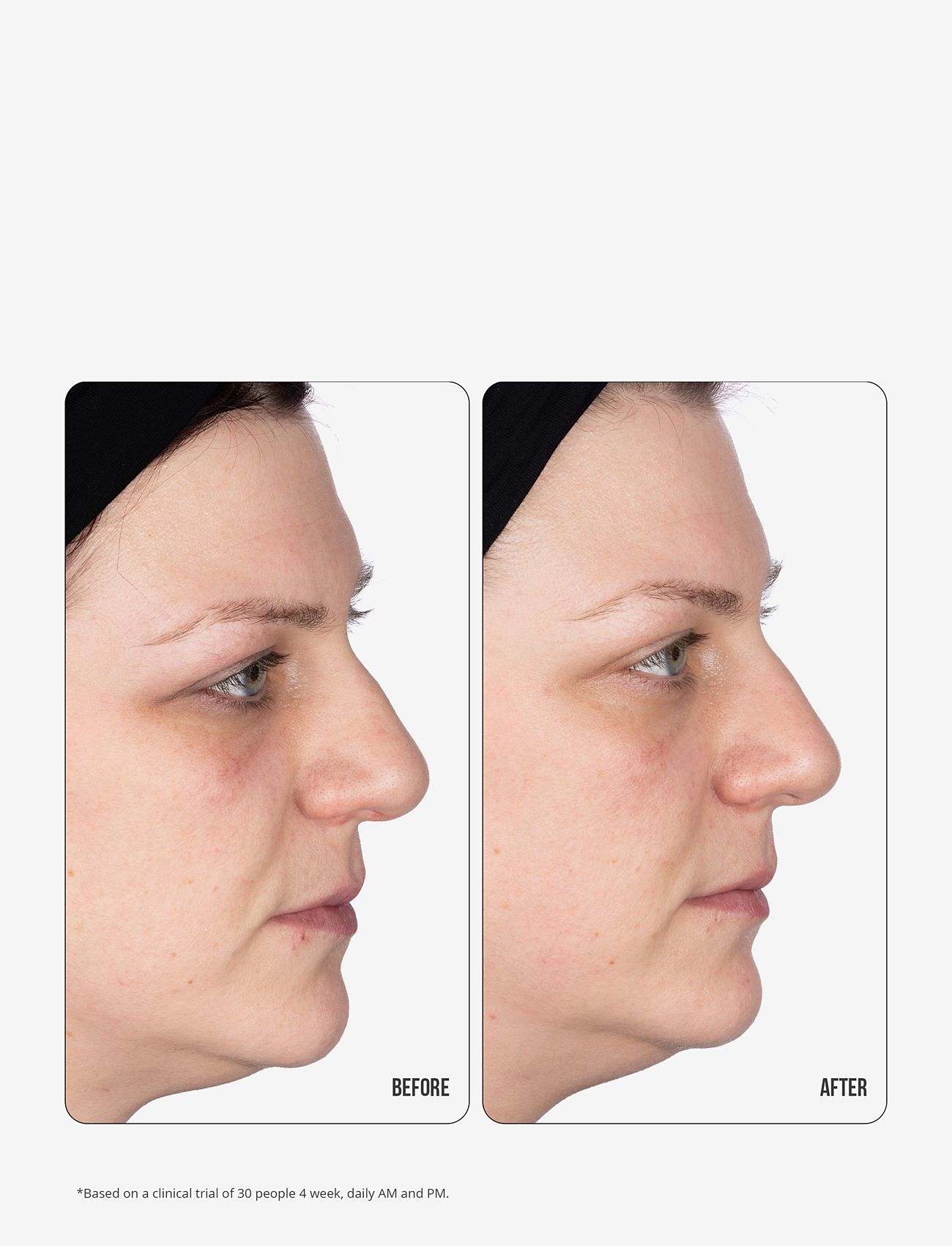 Nip+Fab - Vitamin C Fix Eye Cream 10% 15ml - silmänympärysvoiteet - no color - 2