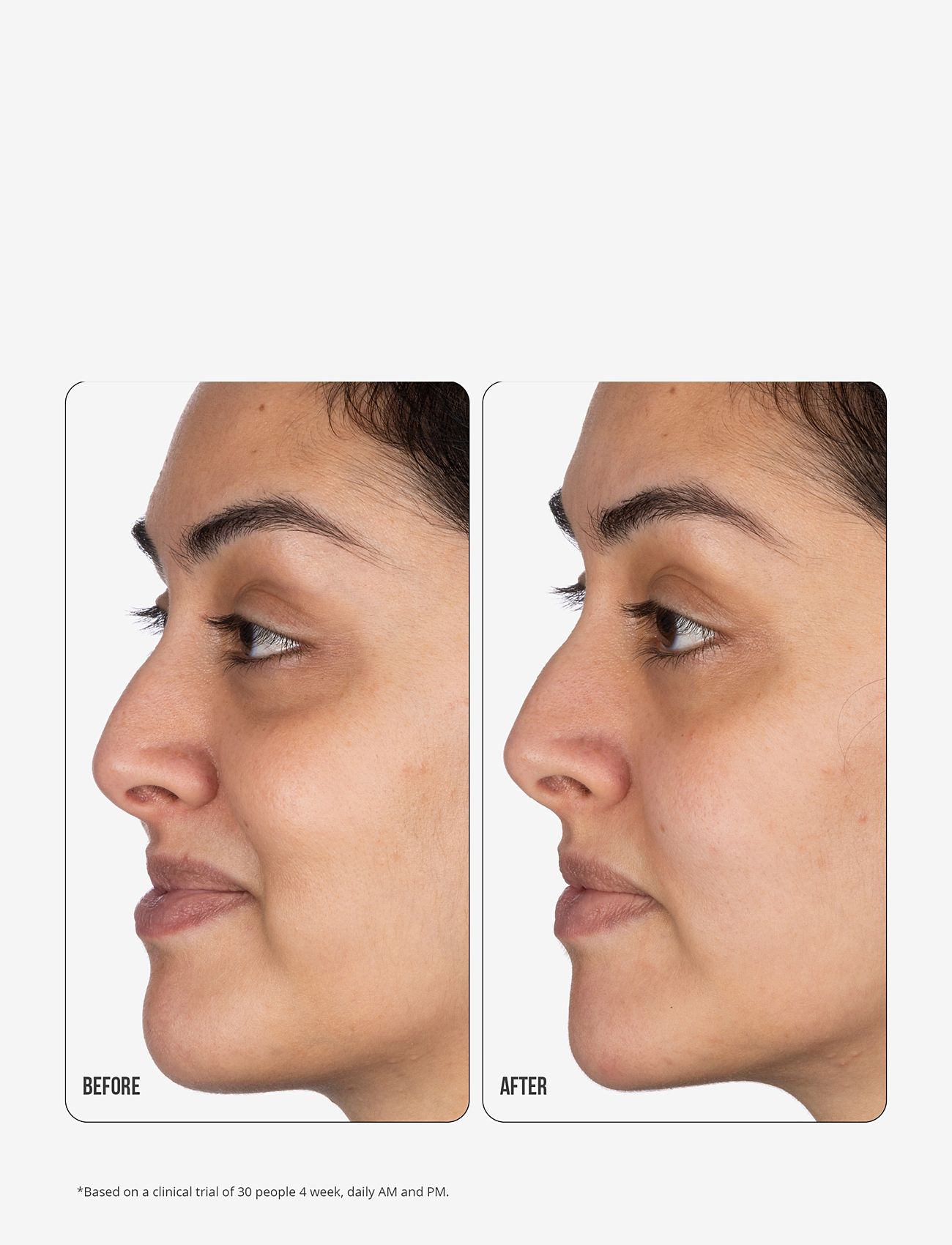 Nip+Fab - Vitamin C Fix Eye Cream 10% 15ml - silmänympärysvoiteet - no color - 5