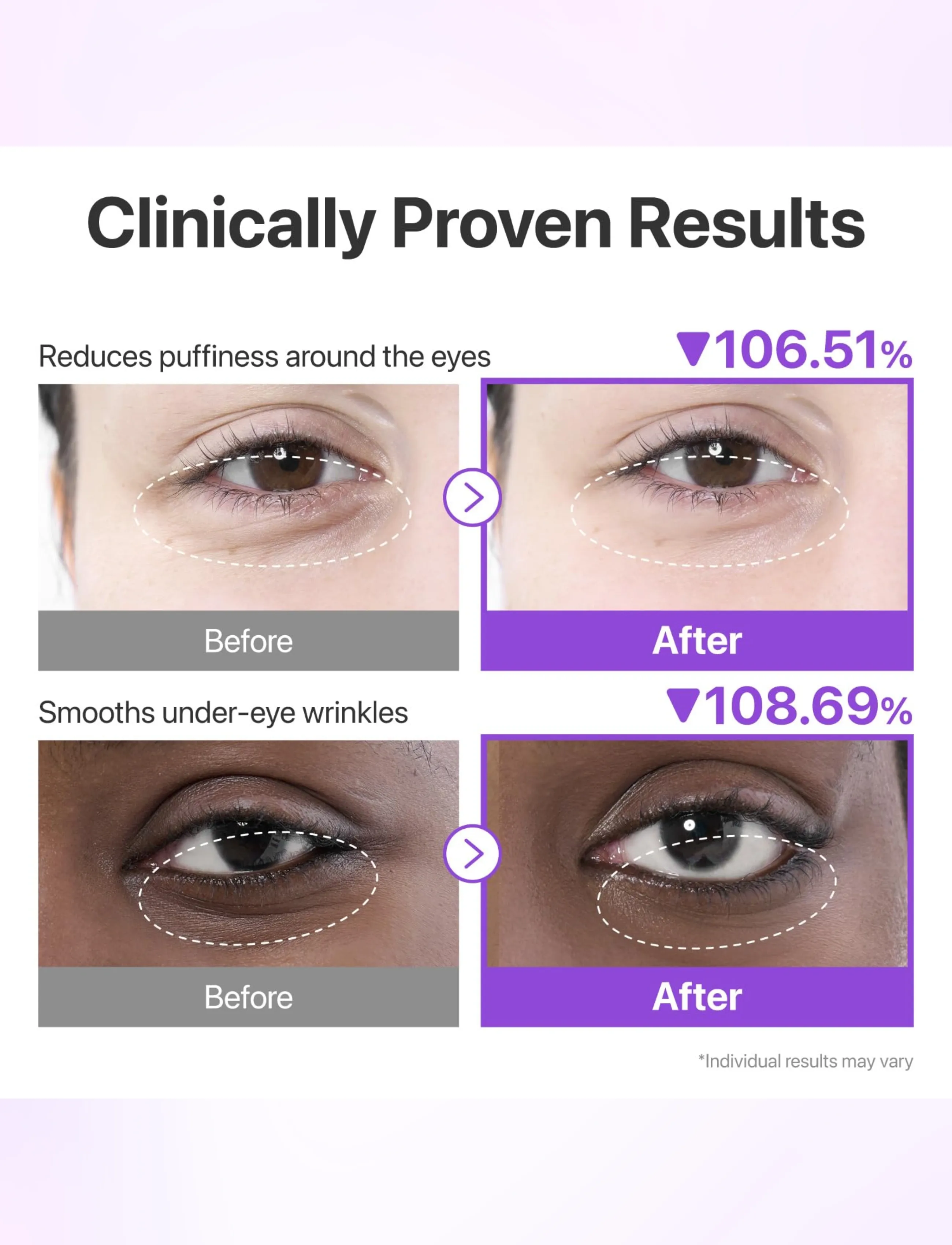 Numbuzin - No.9 NAD Under Eye Patches - Øjenmasker - clear - 2