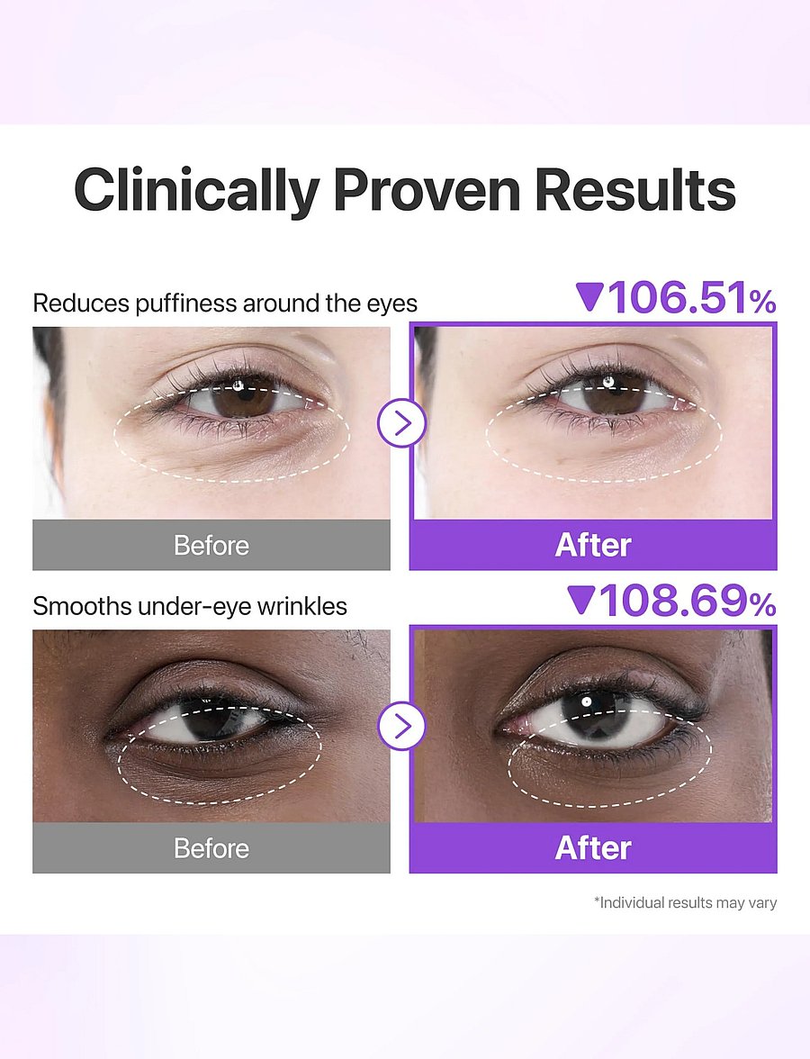 Numbuzin - No.9 NAD Under Eye Patches - Øjenmasker - clear - 2