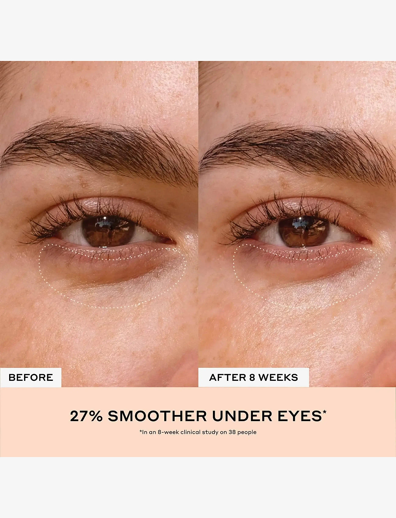 Ole Henriksen - Banana Bright+ Eye Crème - silmänympärysvoiteet - no color - 3