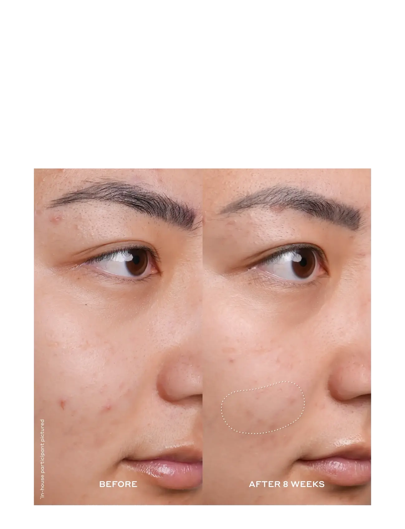 Ole Henriksen - Banana Bright Vitamin C Serum - serum & oljor  - no color - 3