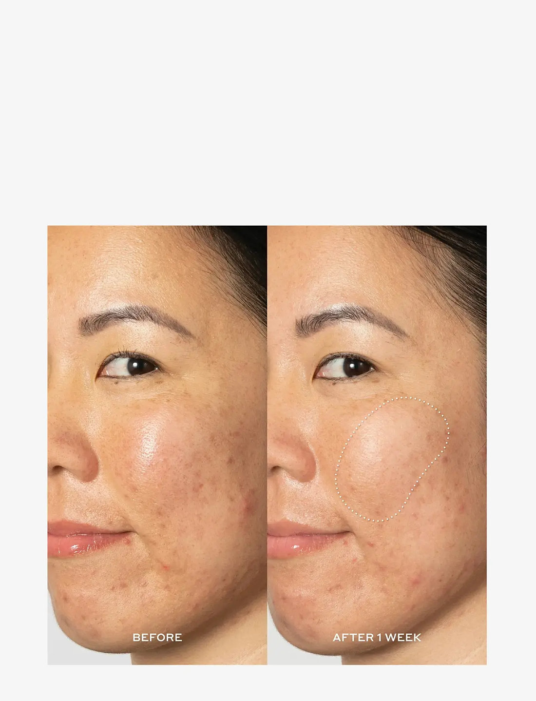 Ole henriksen deals dark spot toner