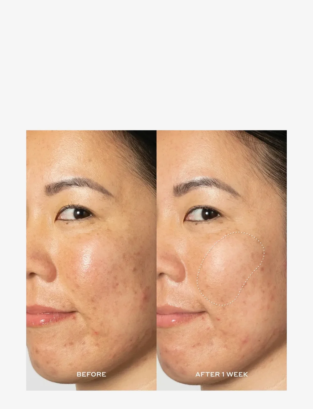 Ole Henriksen - Glow2OH Dark Spot Toner - exfolierande ansiktsvatten - no color - 4