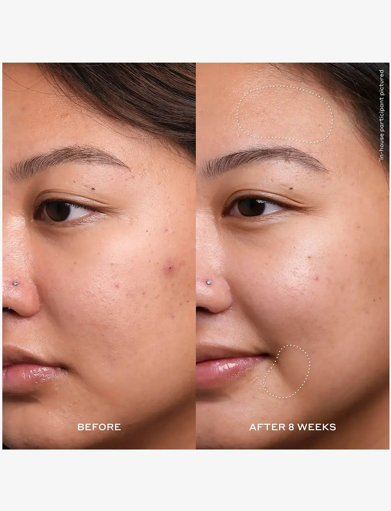 Ole Henriksen - TRANSFORM DEWTOPIA 20% ACID TREATMENT - serum & oljor  - no color - 4