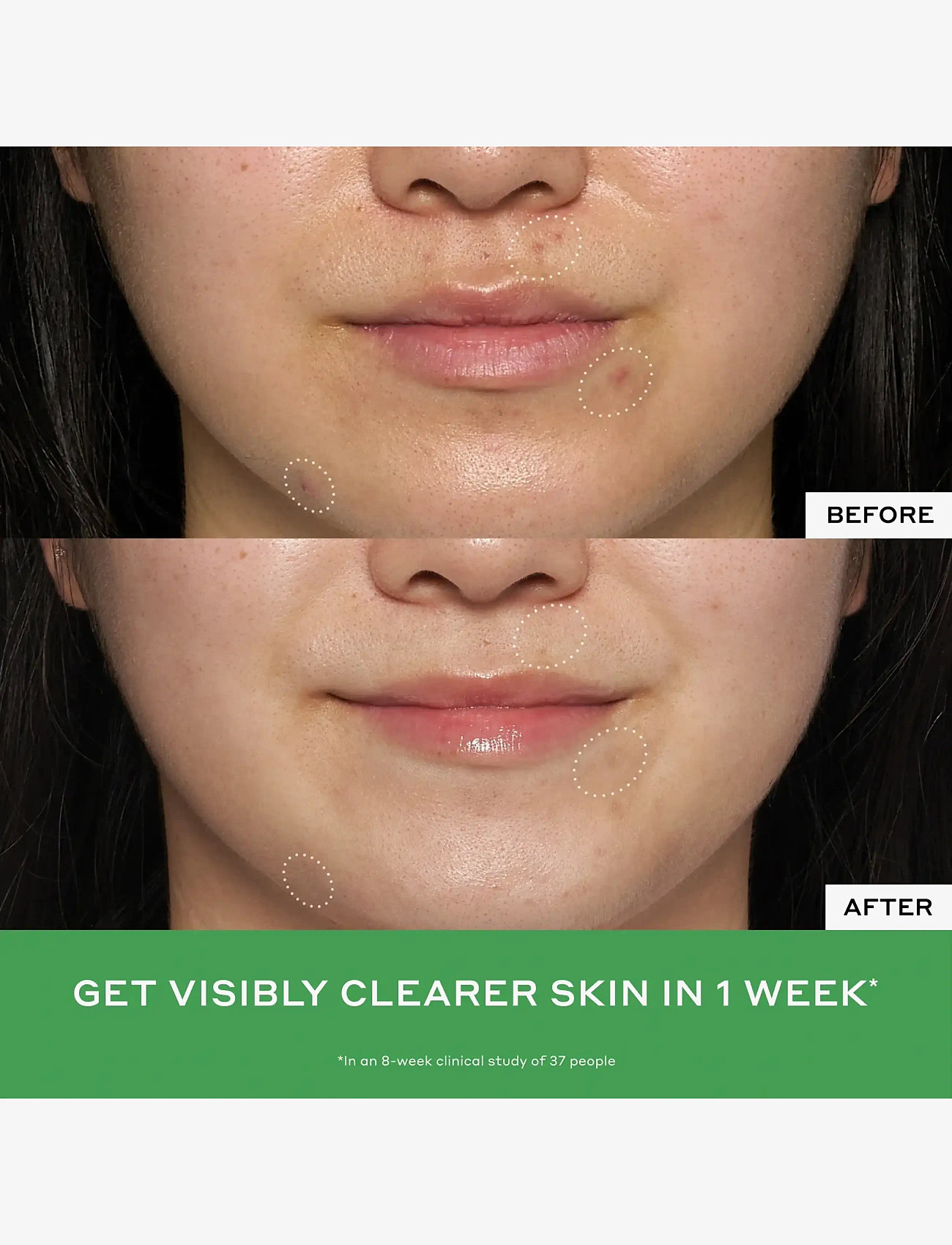 Ole Henriksen - BALANCE Detox drops 2% salicylic acid toner 120ML - exfolierande ansiktsvatten - clear - 3