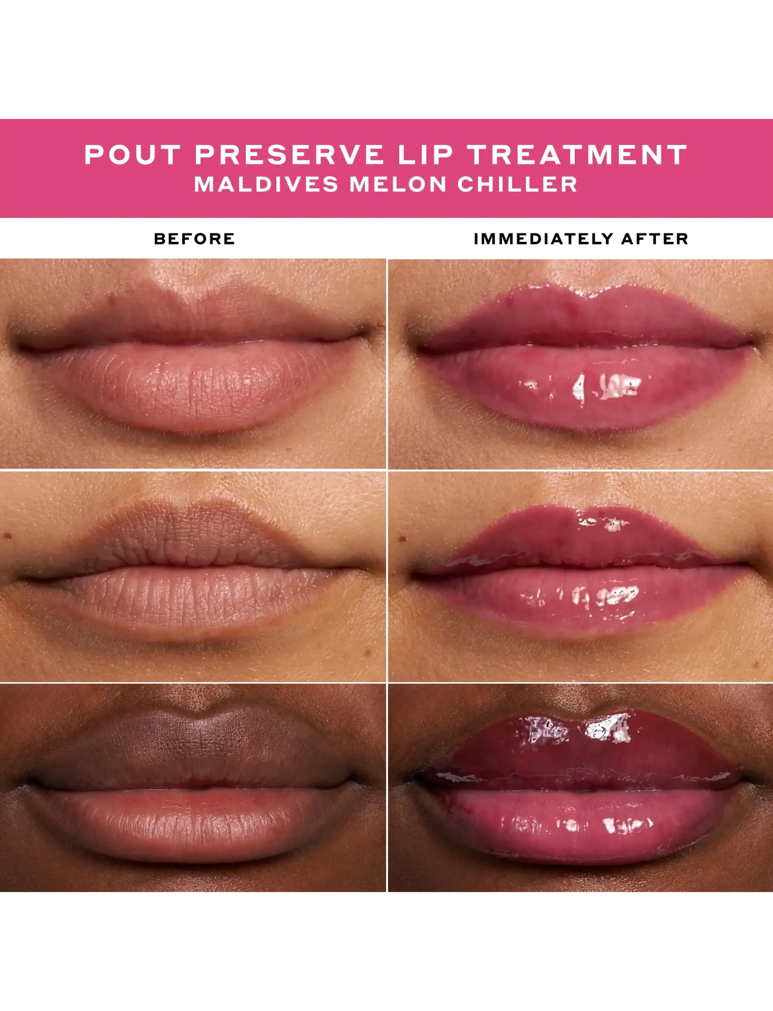 Pout Preserve Lip Treatment 5