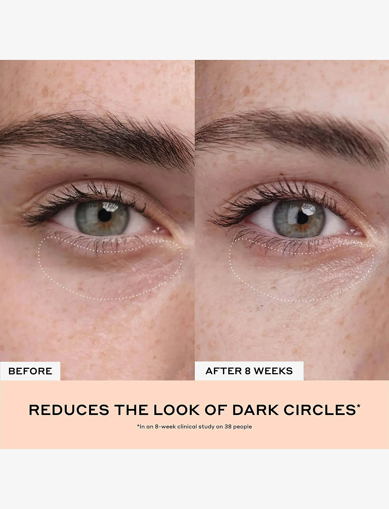 Ole Henriksen - SETS Clinical Quick Fix Mini Vitamin C + Peptide Duo 14 ml - læbepomade - clear - 3