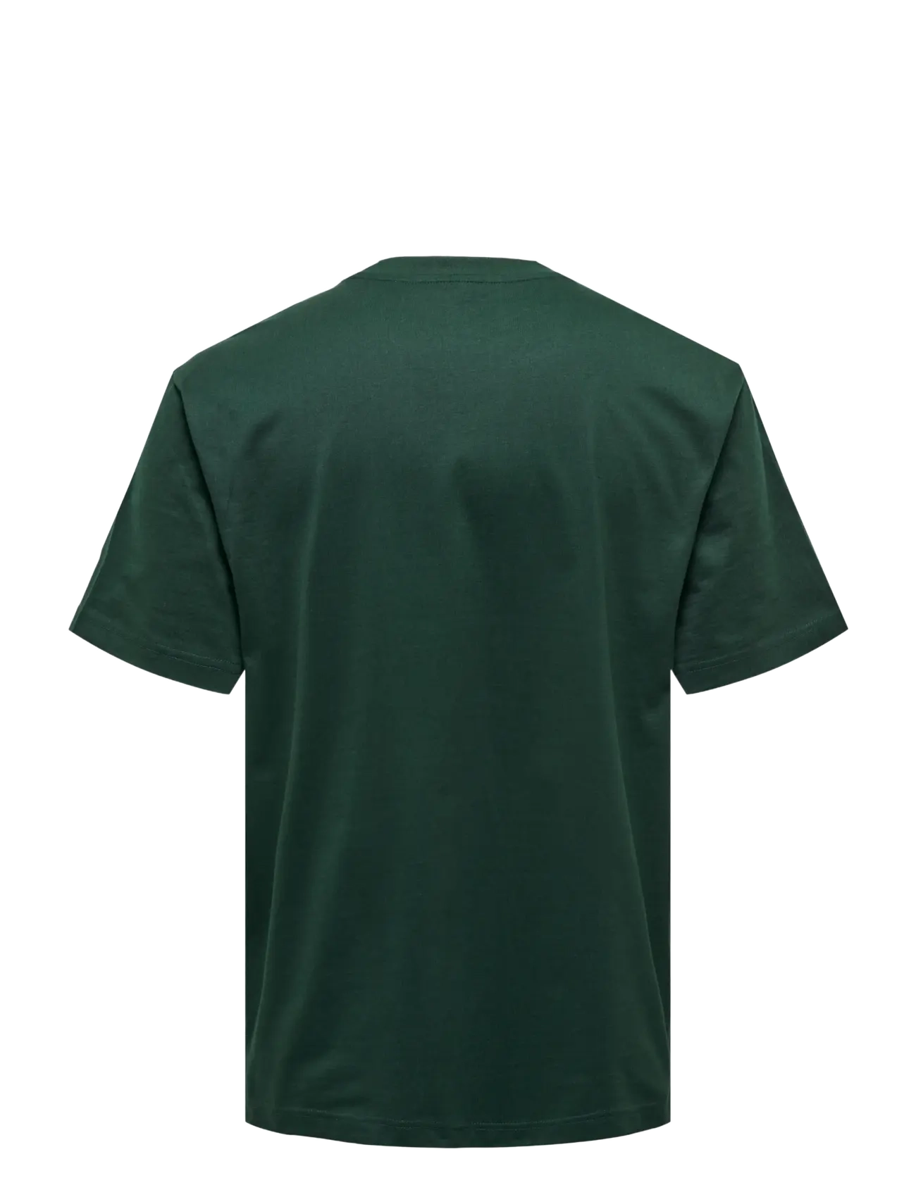 ONLY & SONS - ONSFRED LIFE RLX SS TEE NOOS - lühikeste varrukatega t-särgid - darkest spruce - 2