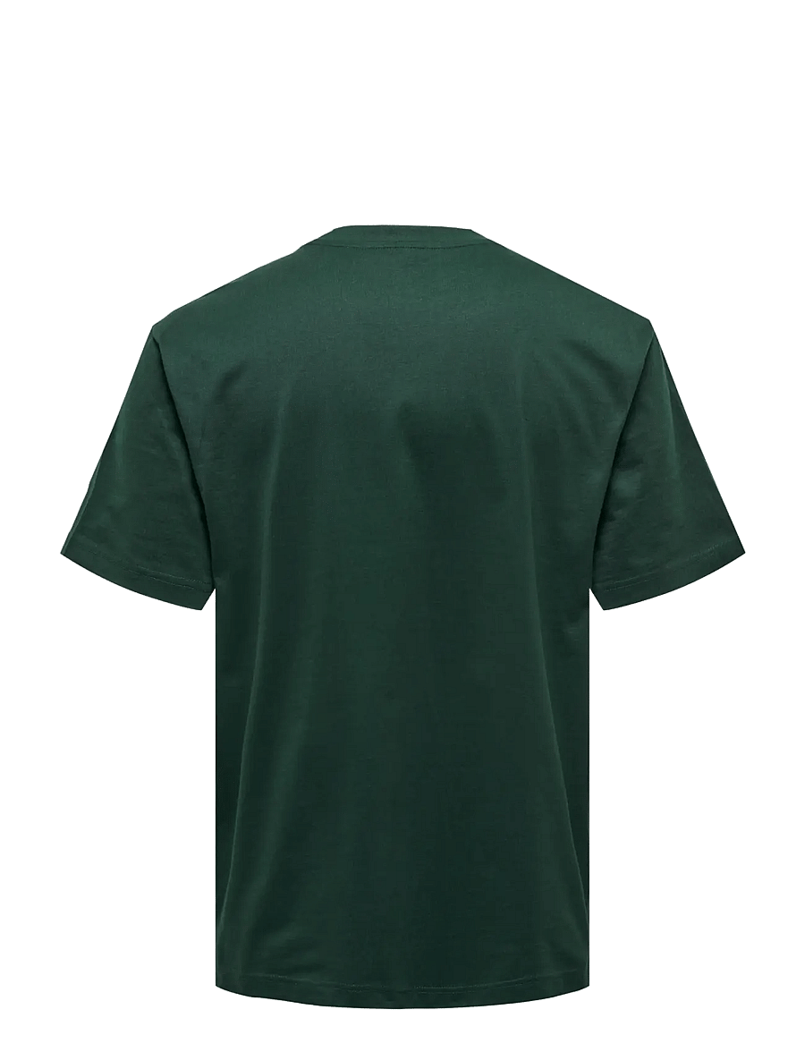 ONLY & SONS - ONSFRED LIFE RLX SS TEE NOOS - lühikeste varrukatega t-särgid - darkest spruce - 2