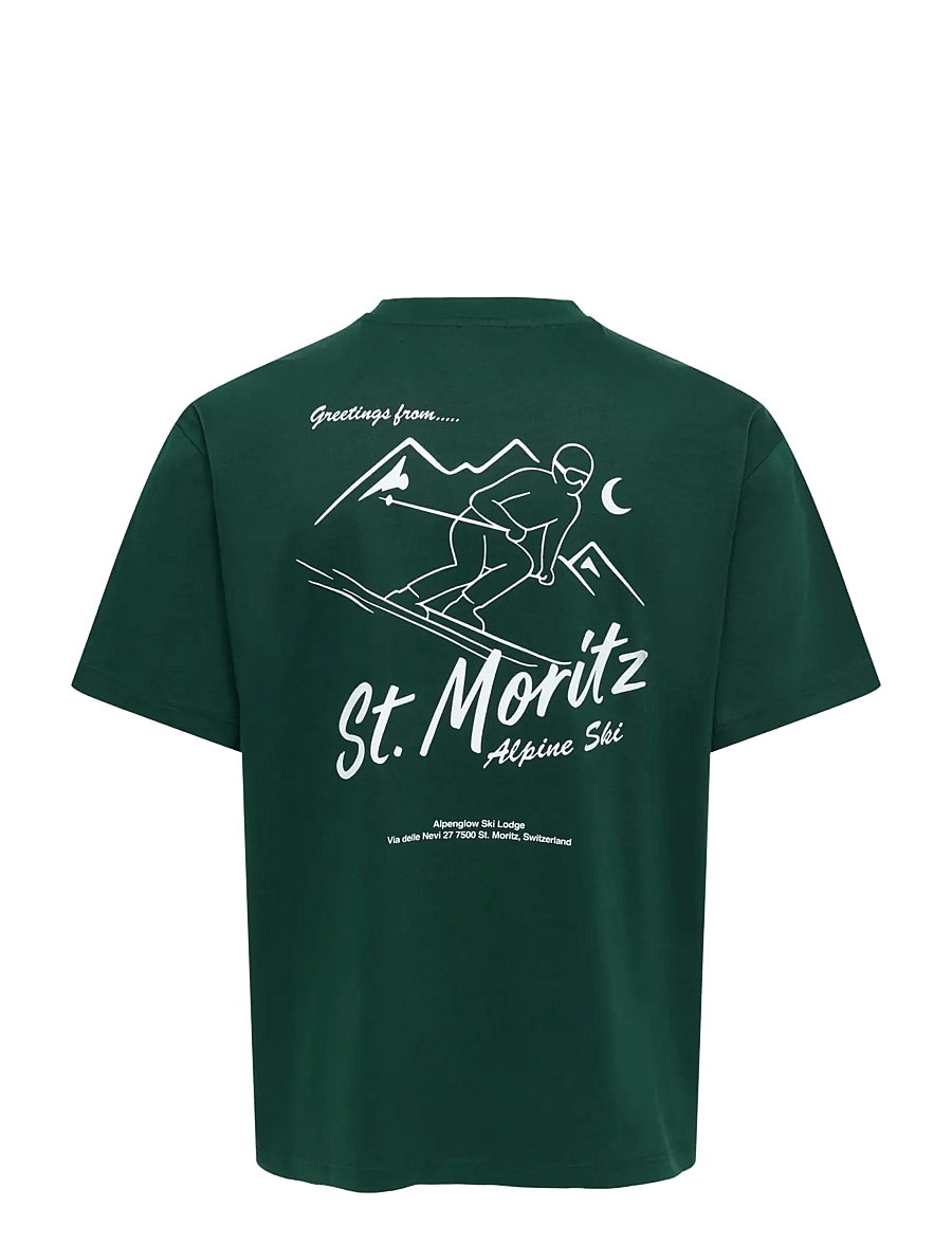 ONLY & SONS - ONSFRED LIFE RLX SS PRINT TEE VD - kurzärmelige t-shirts - pine grove - 1