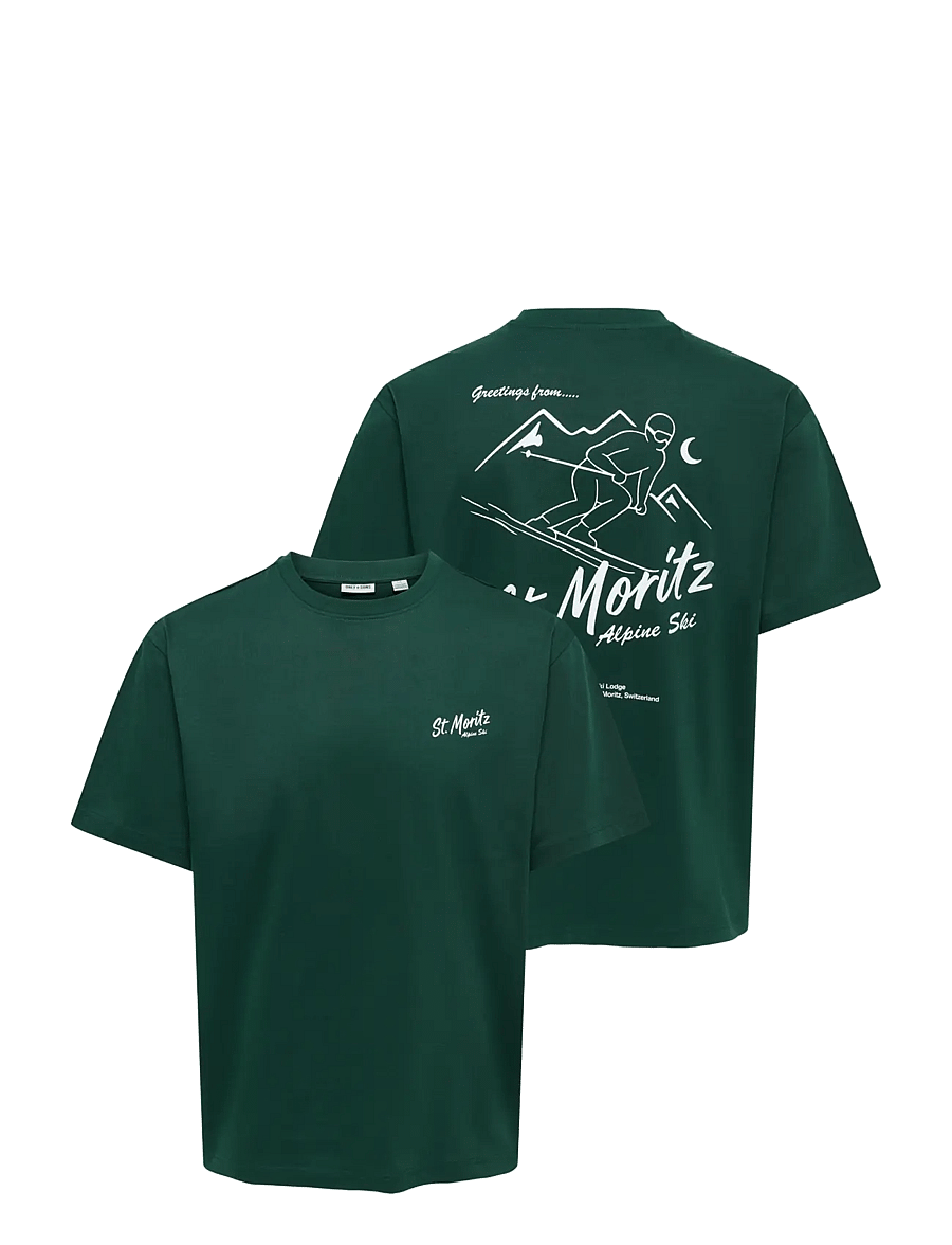 ONLY & SONS - ONSFRED LIFE RLX SS PRINT TEE VD - kurzärmelige t-shirts - pine grove - 2