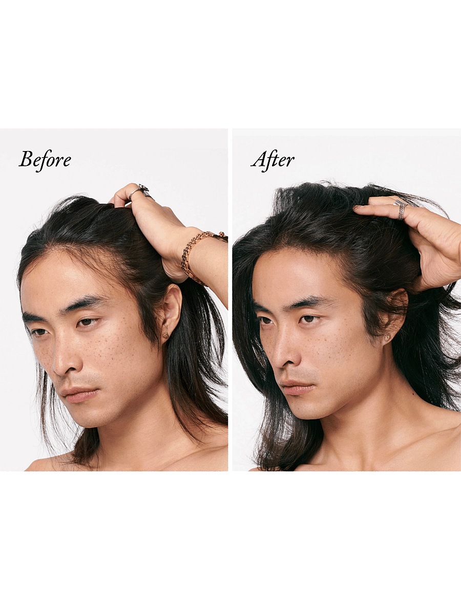Oribe - Serene Scalp DensifyingTreatment Spray - meðferðir fyrir hársvörð - clear - 3
