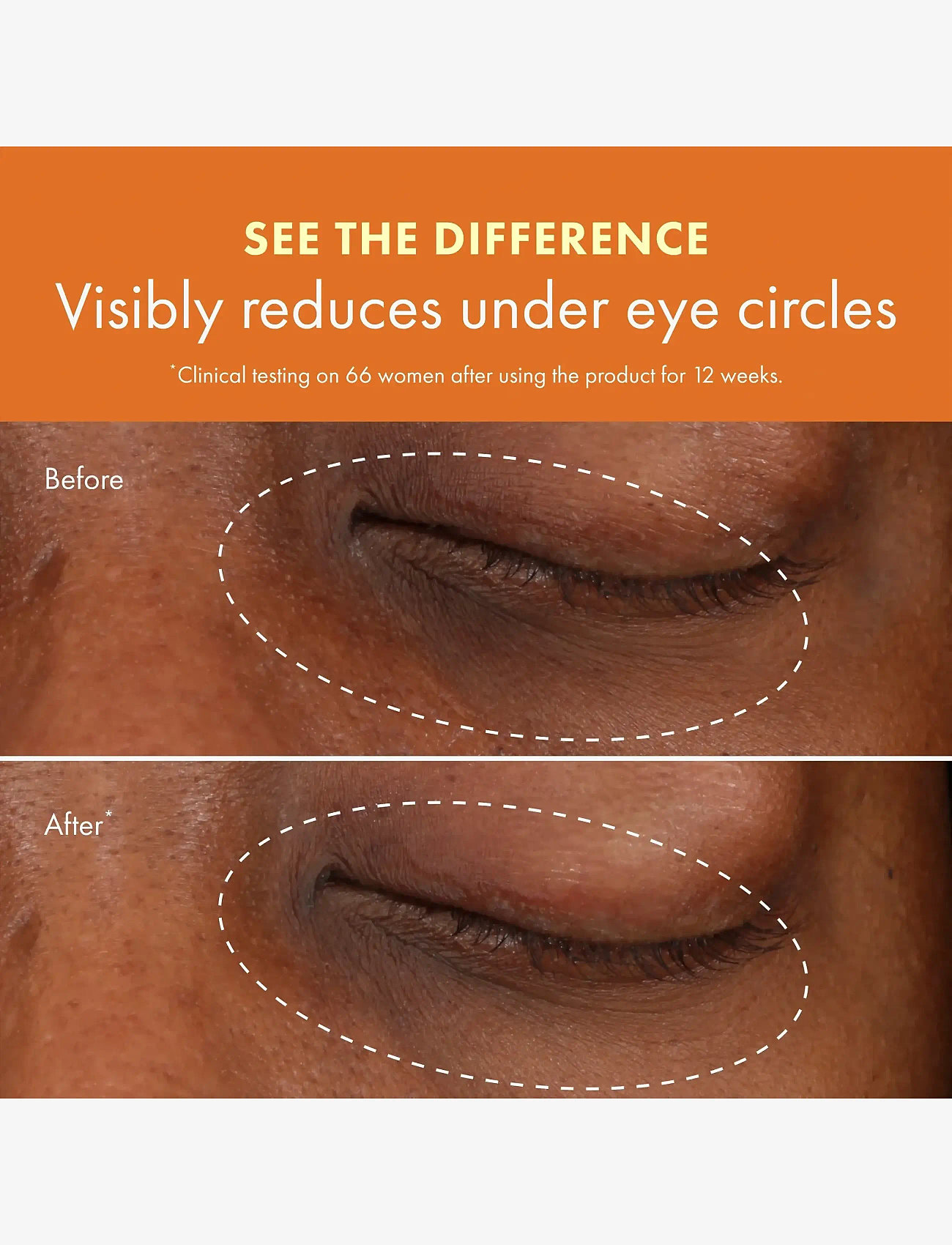 Origins - Ginzing Brightening Eye Cream - Warm - Ögonkräm - clear - 5