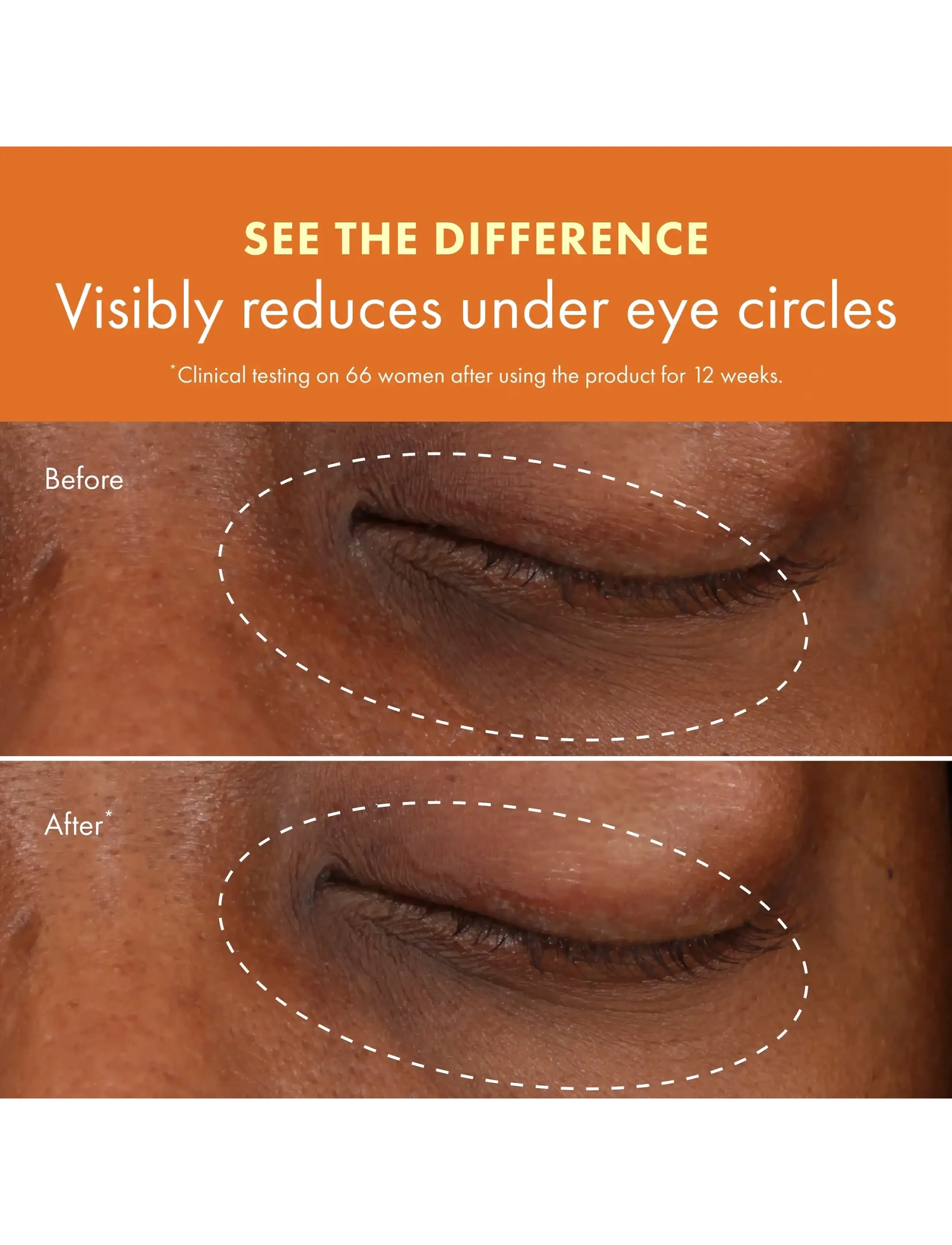Origins - Ginzing Brightening Eye Cream - Warm - Øyekrem - clear - 5