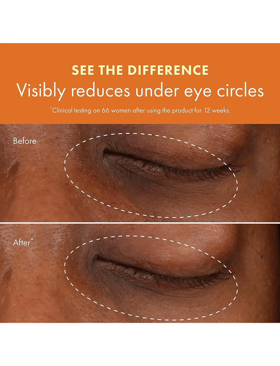 Origins - Ginzing Brightening Eye Cream - Warm - augnkrem - clear - 5