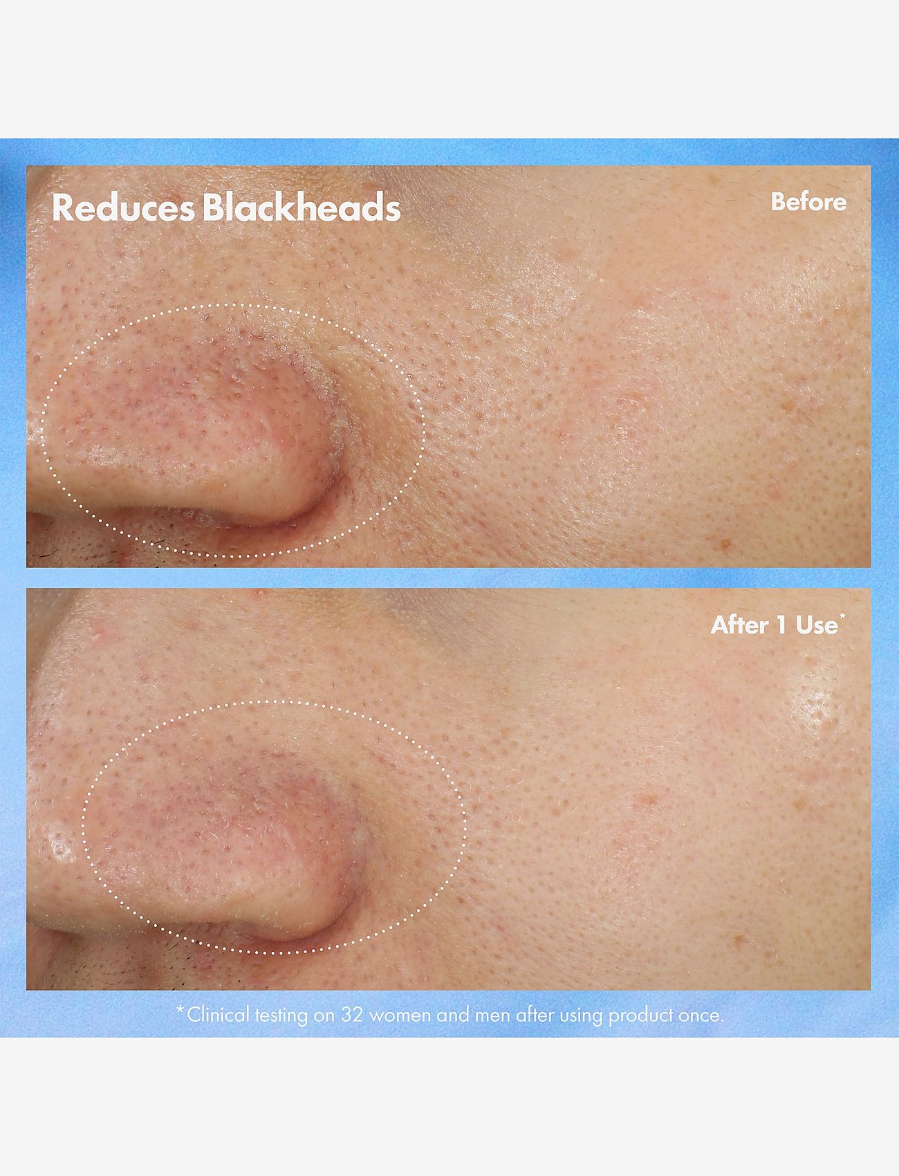 Origins - Clear Improvement Blackhead Clearing Mask-To-Scrub - leiremaske - multi - 2