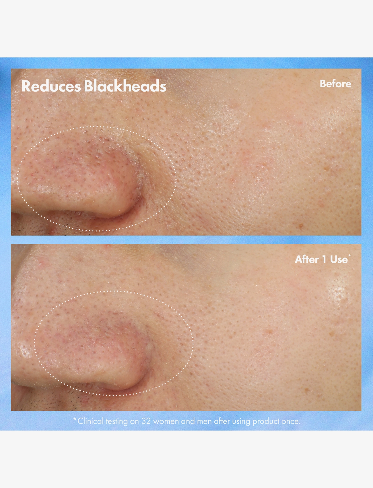Origins - Clear Improvement Blackhead Clearing Mask-To-Scrub - lermasker - multi - 2