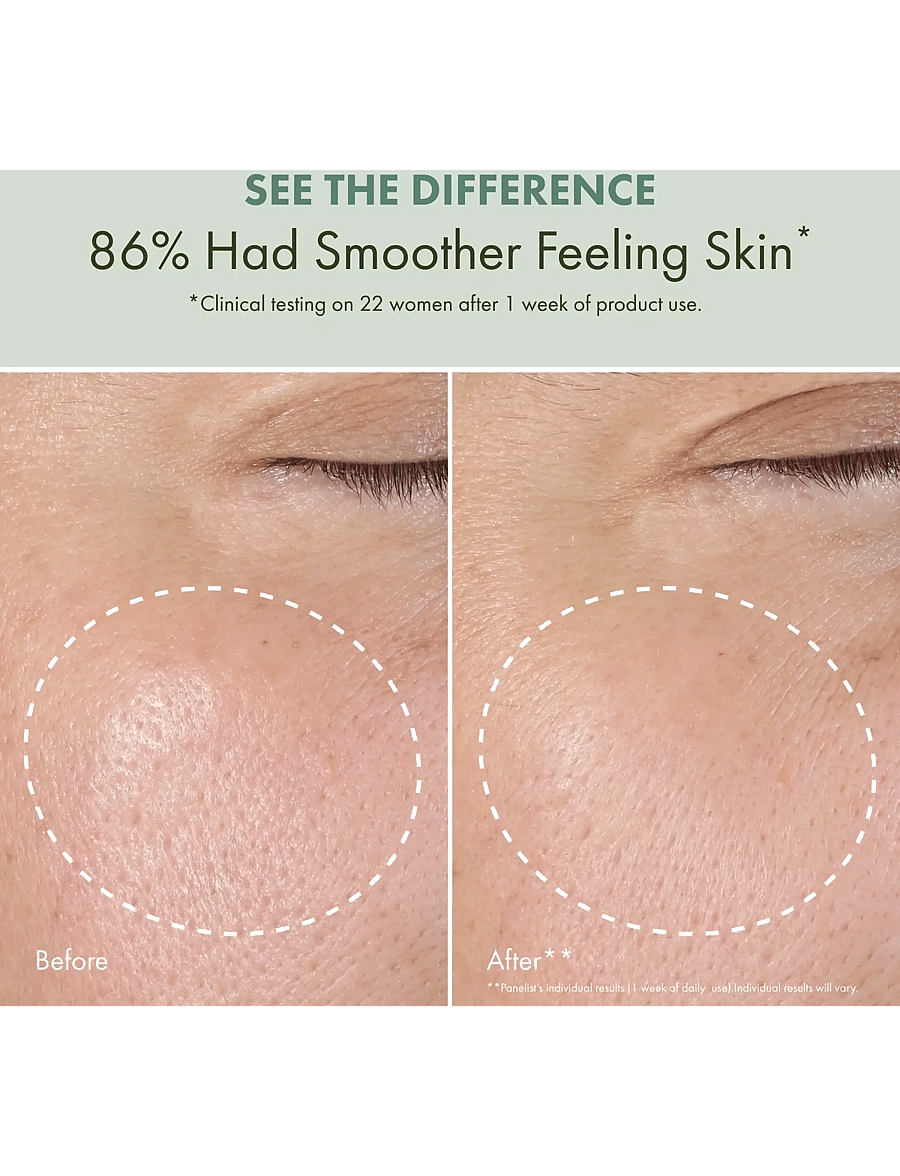 Origins - Checks and Balances™ Daily Exfoliating Toner - exfolierande ansiktsvatten - clear - 2