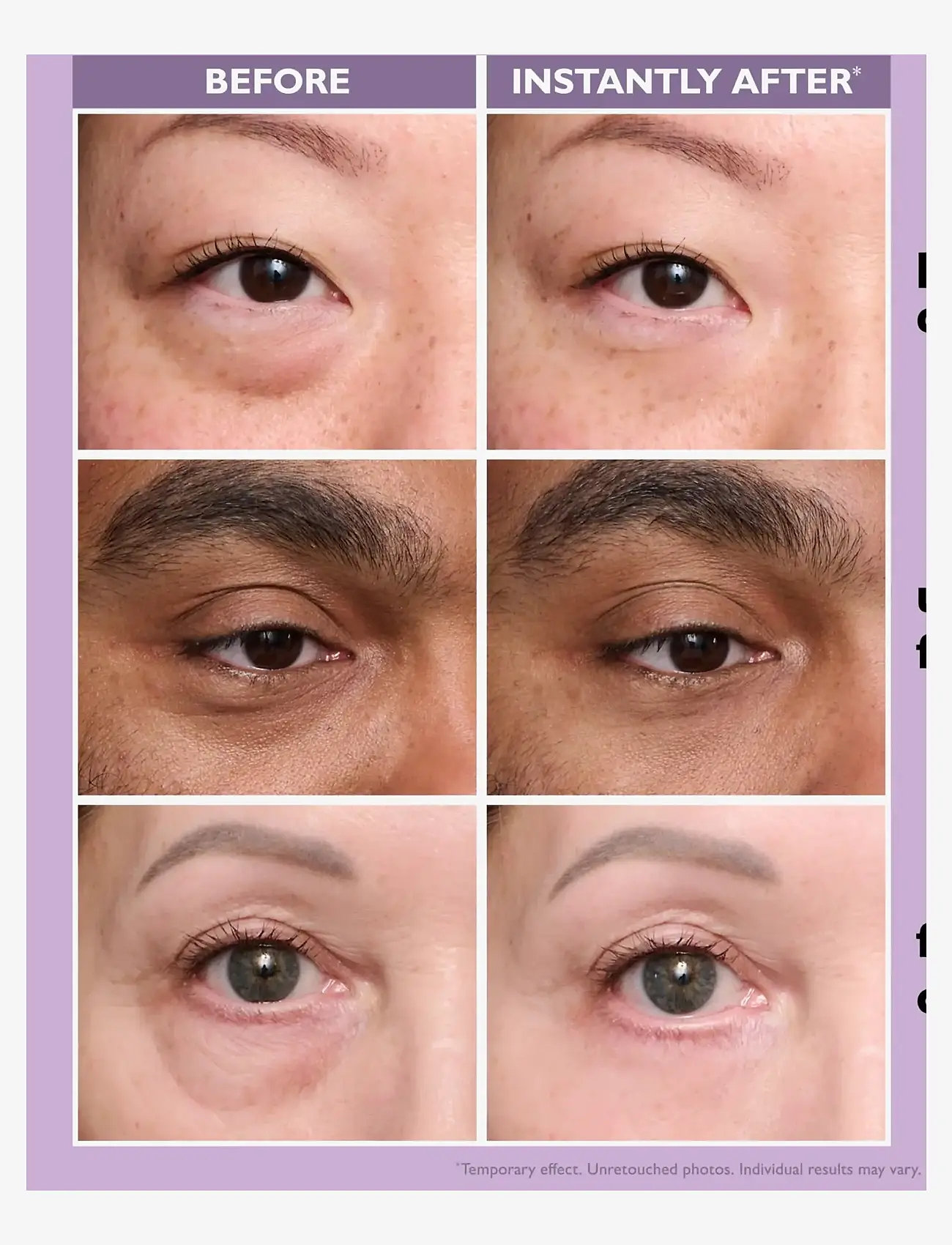 Peter Thomas Roth - Instant FIRMx® Eye Temporary Eye Tightener Easy-Wear - no color - 2