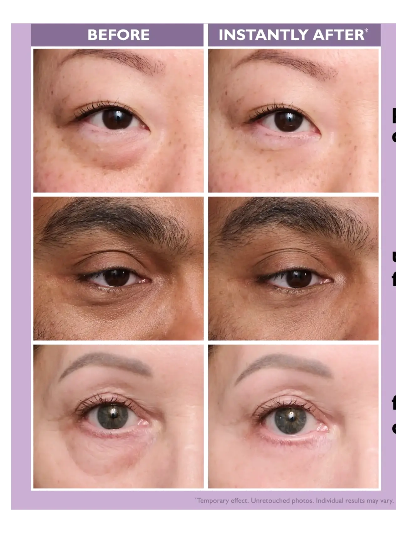 Peter Thomas Roth - Instant FIRMx® Eye Temporary Eye Tightener Easy-Wear - augnkrem - no color - 2