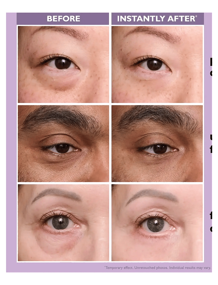 Peter Thomas Roth - Instant FIRMx® Eye Temporary Eye Tightener Easy-Wear - silmakreem - no color - 2