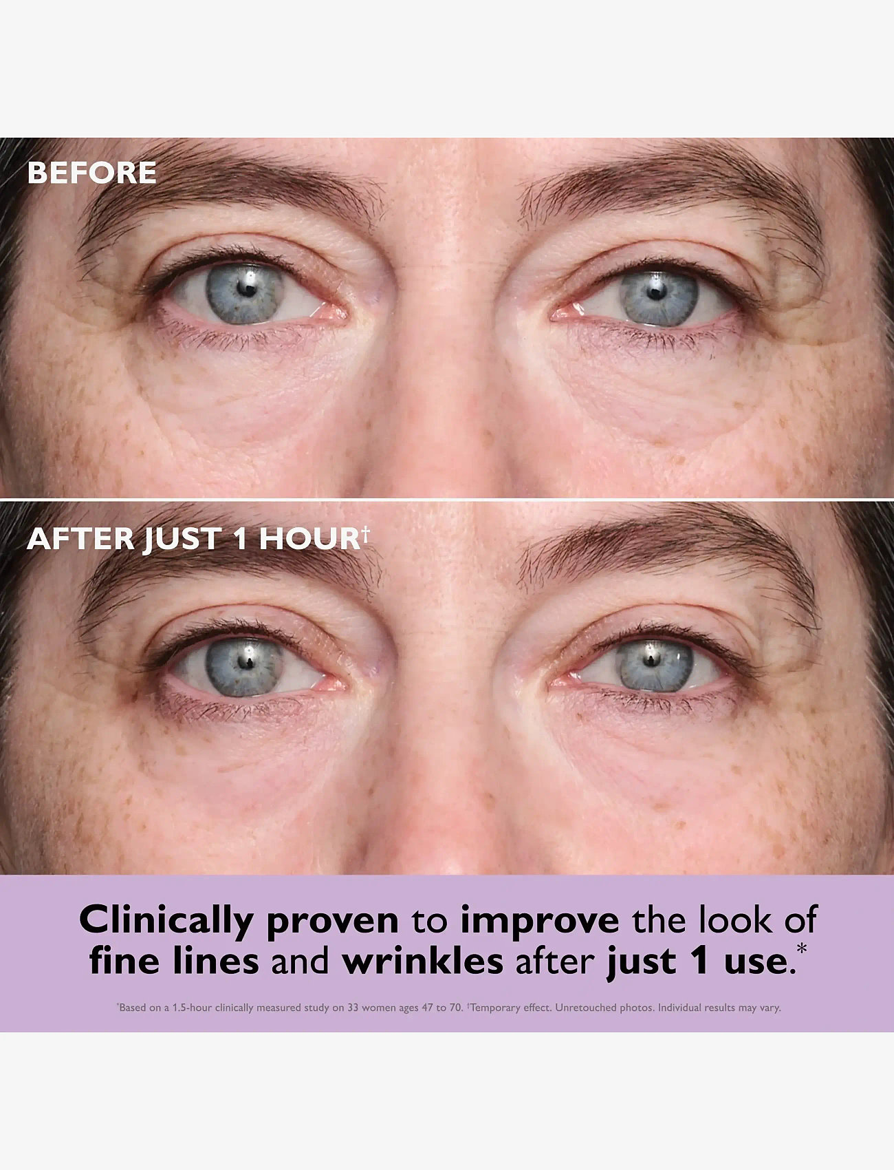 Peter Thomas Roth - Instant FIRMx® Collagen Infusion Tightening Eye Patches - Øjenmasker - no color - 4