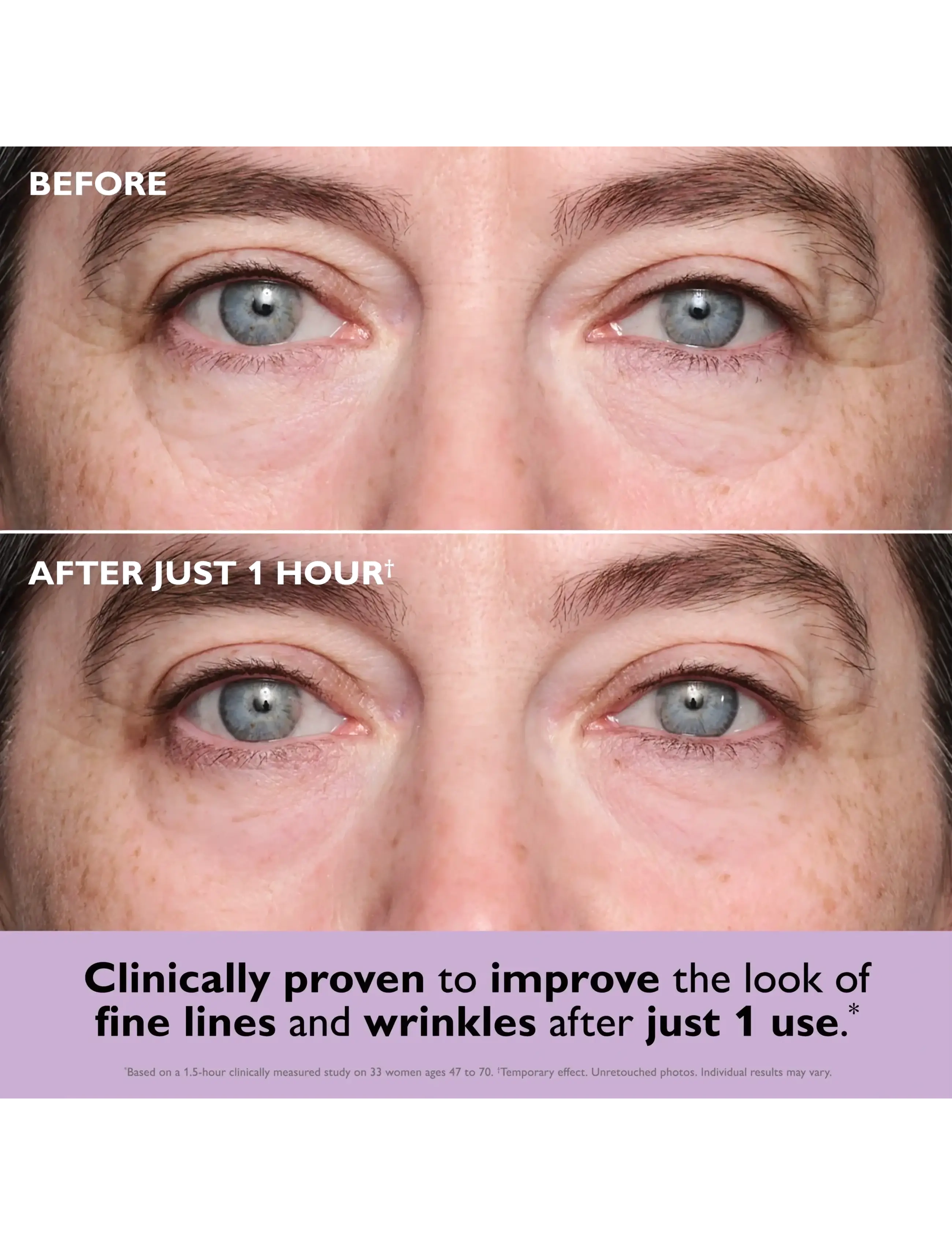 Peter Thomas Roth - Instant FIRMx® Collagen Infusion Tightening Eye Patches - Øjenmasker - no color - 4