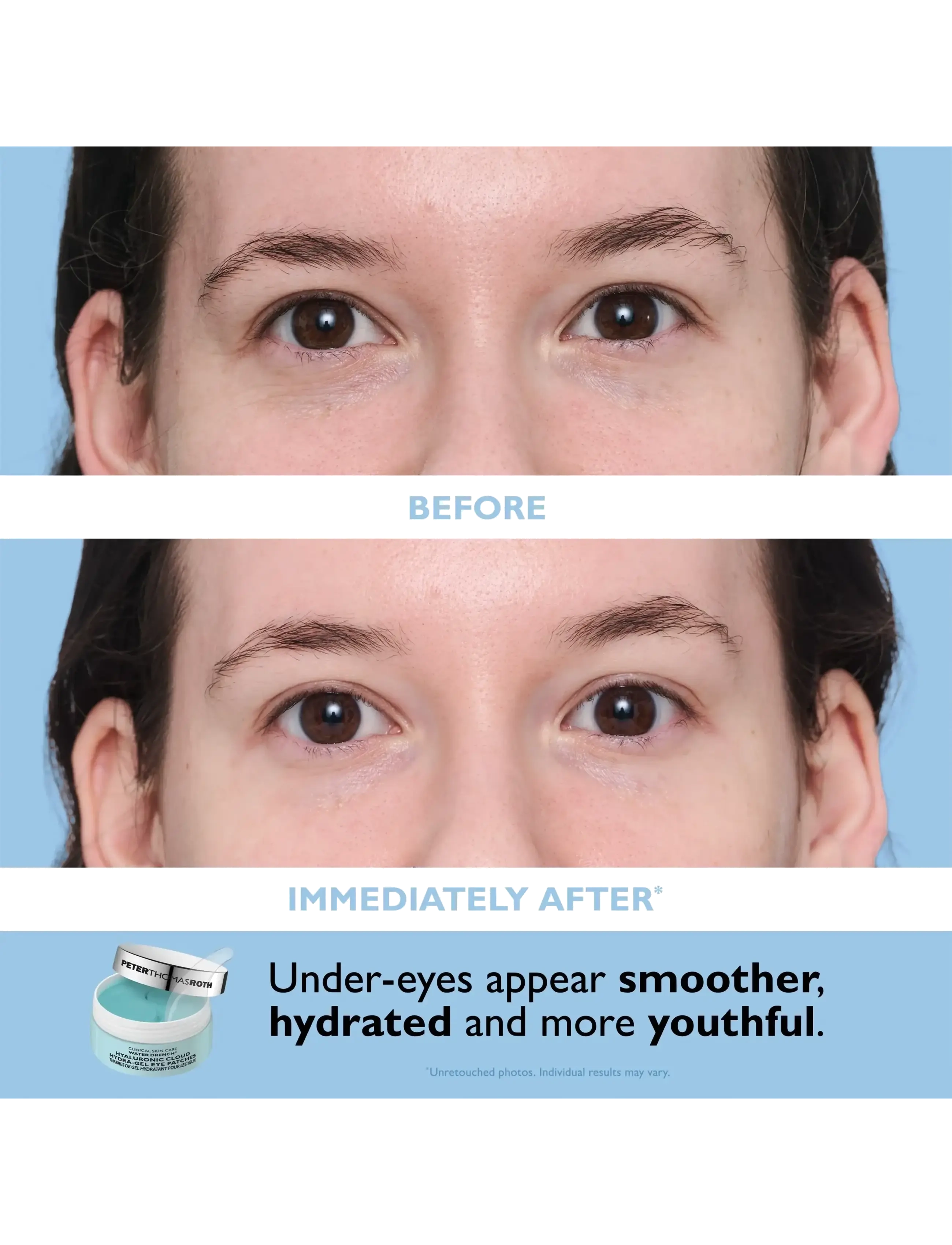 Peter Thomas Roth - Water Drench® Essentials Moisturizer and Eye Patch Set - clear - 4