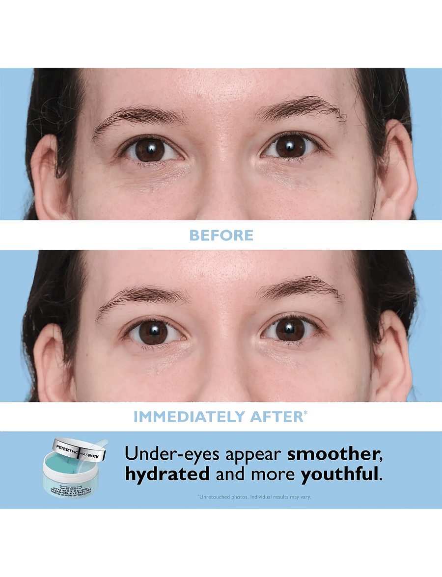 Peter Thomas Roth - Water Drench® Essentials Moisturizer and Eye Patch Set - clear - 4