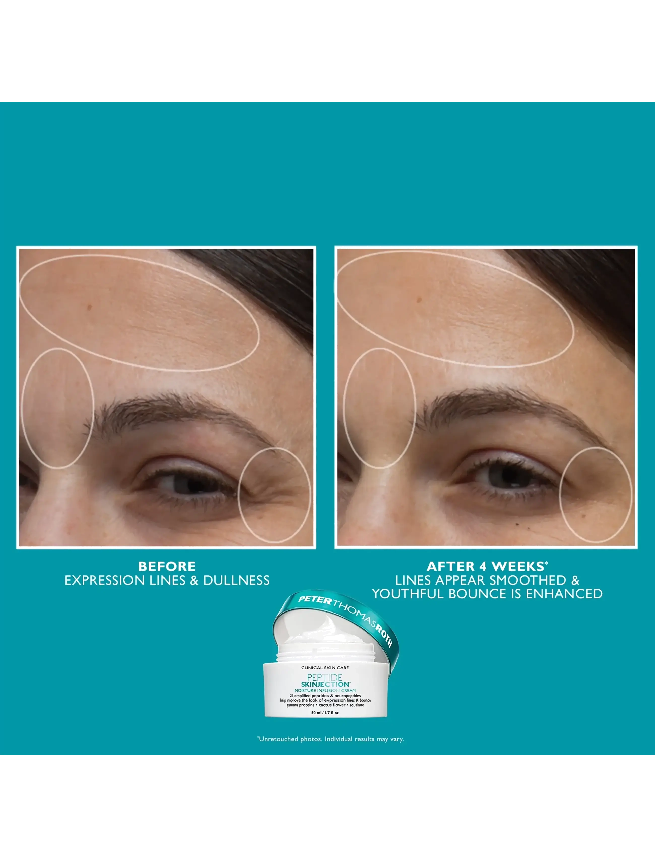 Peter Thomas Roth - Peptide Skinjection™ Face & Eye Kit - clear - 3