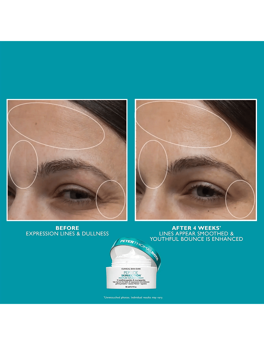 Peter Thomas Roth - Peptide Skinjection™ Face & Eye Kit - clear - 3