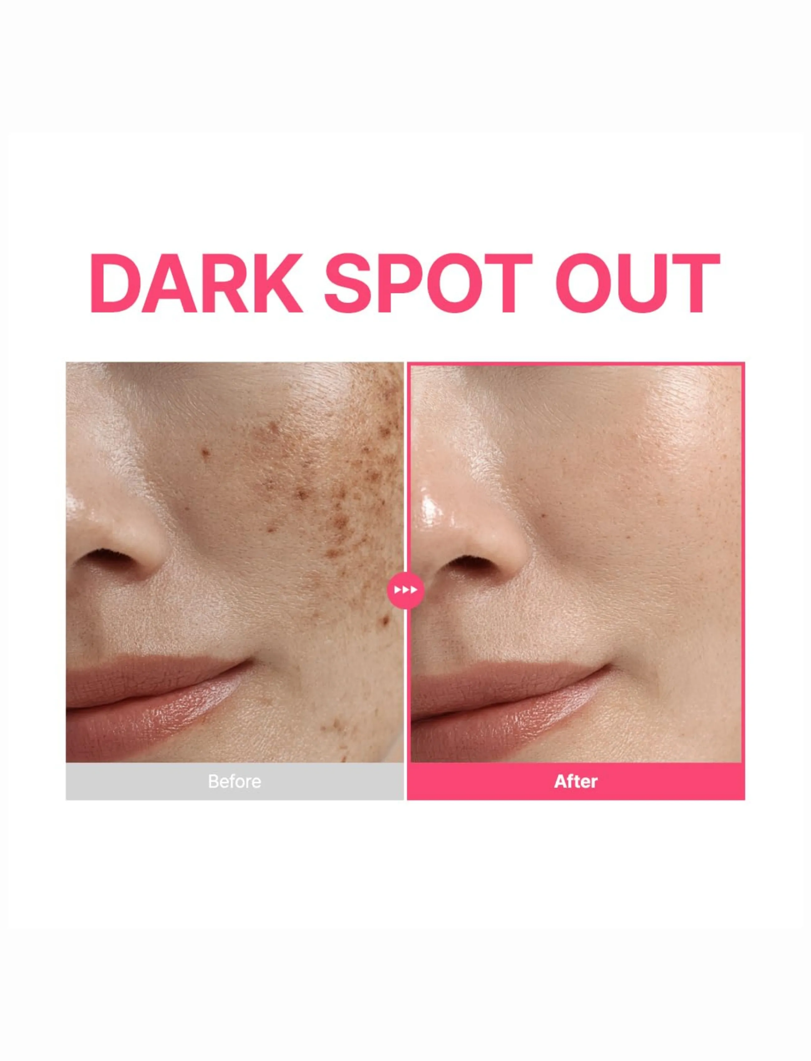 Purito Seoul Txa 6 Niacinamide 10 Retinal Serum, 30 ml, Nude, Ansigt > Serum, Dame