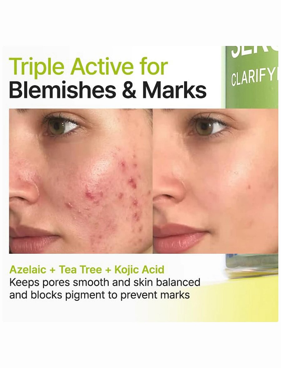 Purito Seoul - Azelaic Acid 10 Kojic Tea Tree Serum - serum - clear - 0