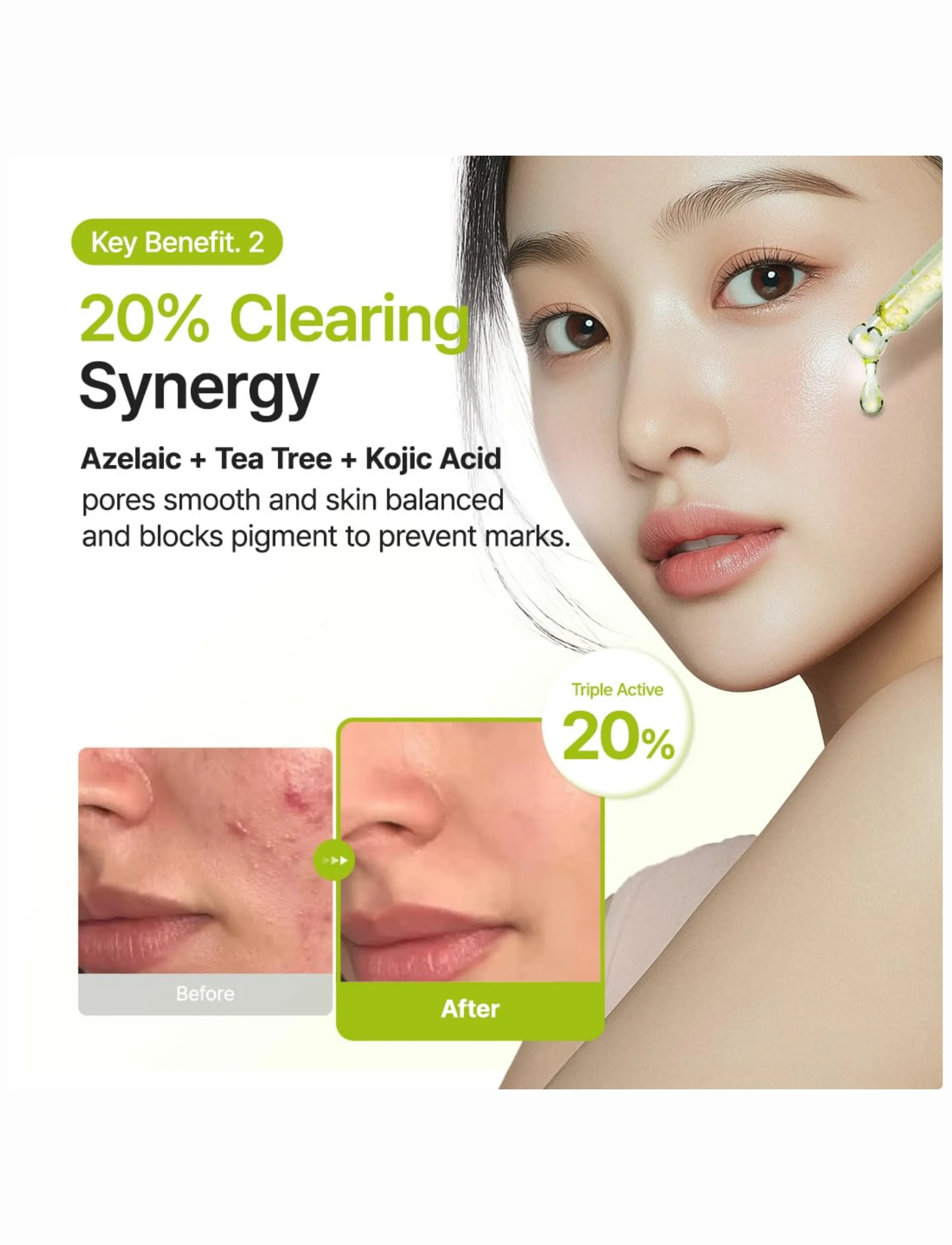 Purito Seoul - Azelaic Acid 10 Kojic Tea Tree Serum - serum - clear - 4