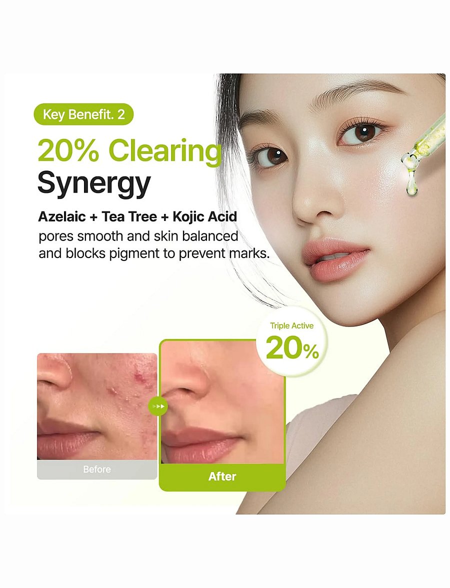 Purito Seoul - Azelaic Acid 10 Kojic Tea Tree Serum - serum - clear - 4
