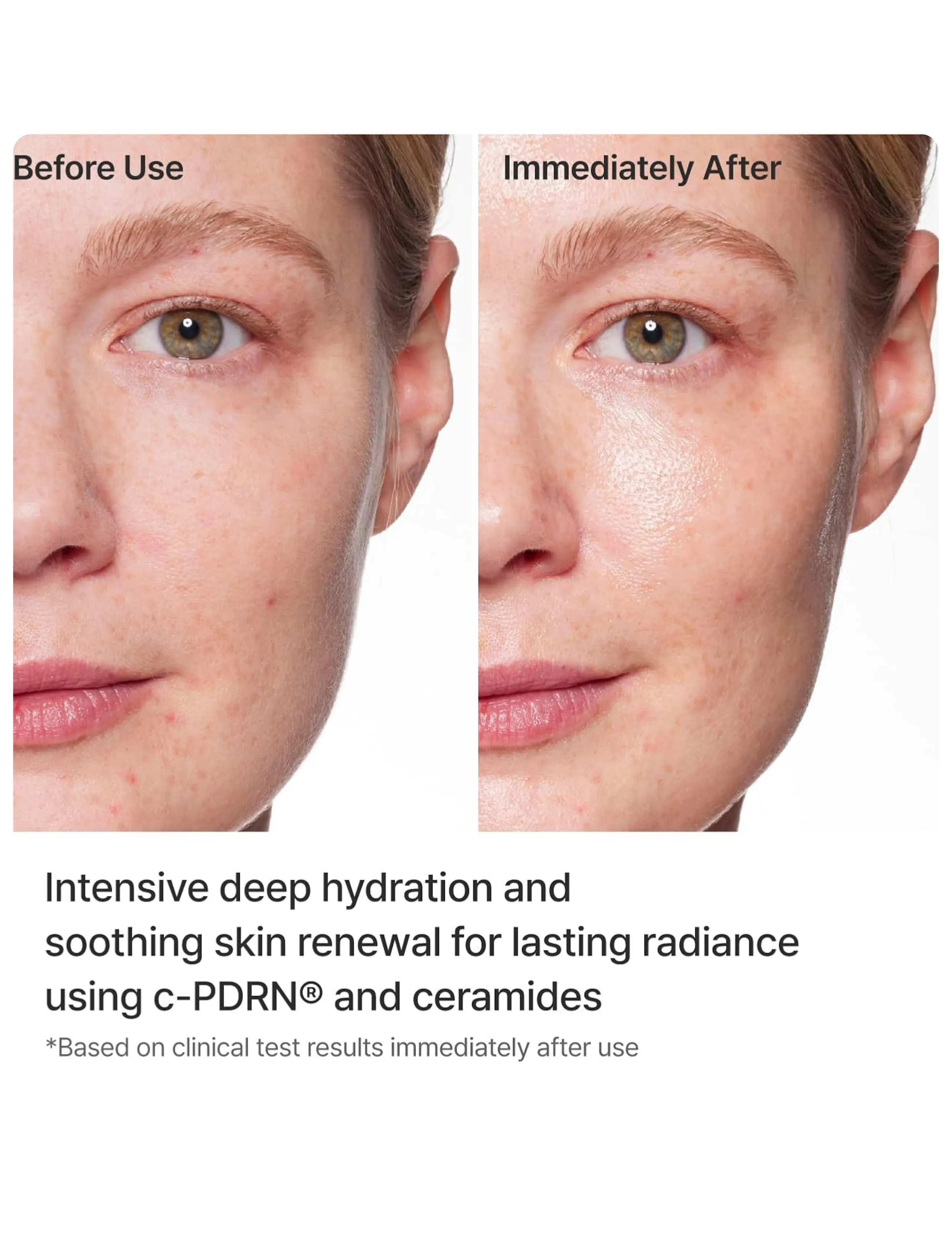 Rejuran - Turnover Mask - sheet masks - clear - 3
